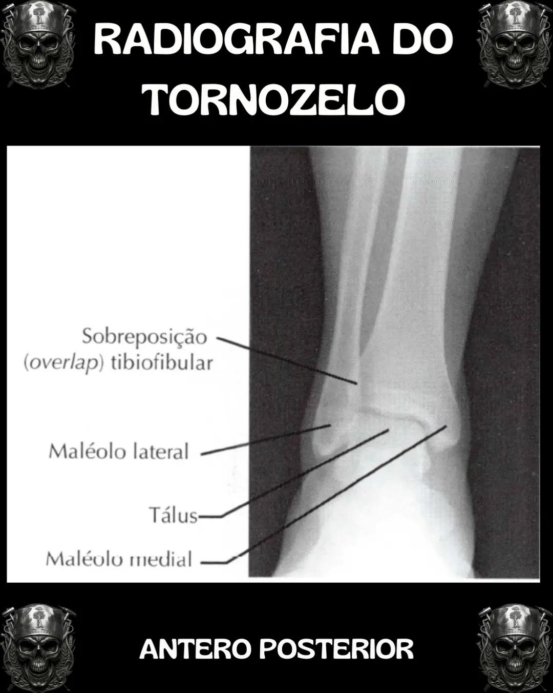 @Traumatologia Maluca