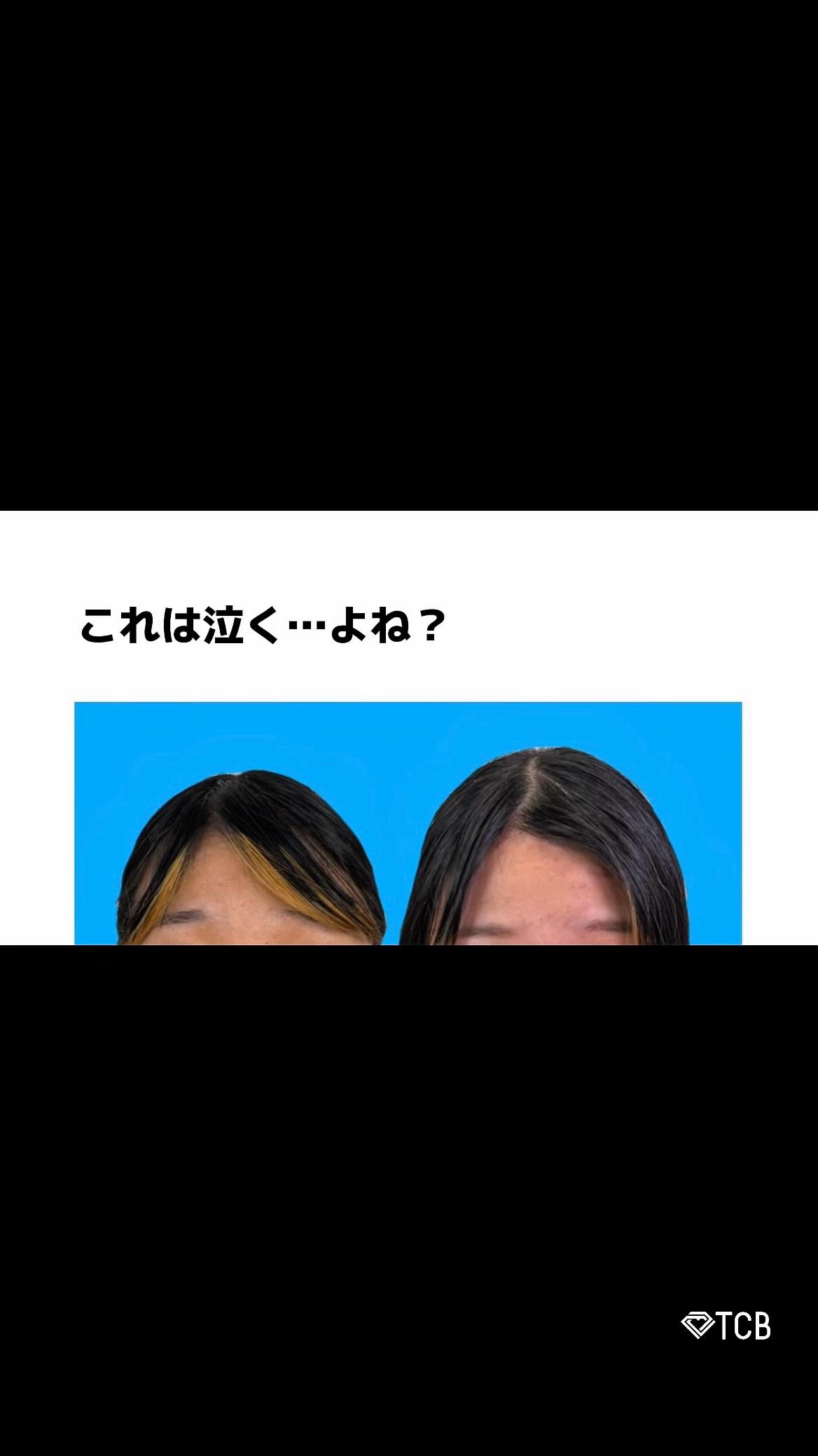@【二重整形】TCB 新宿東口院ゆいこ先生/東京