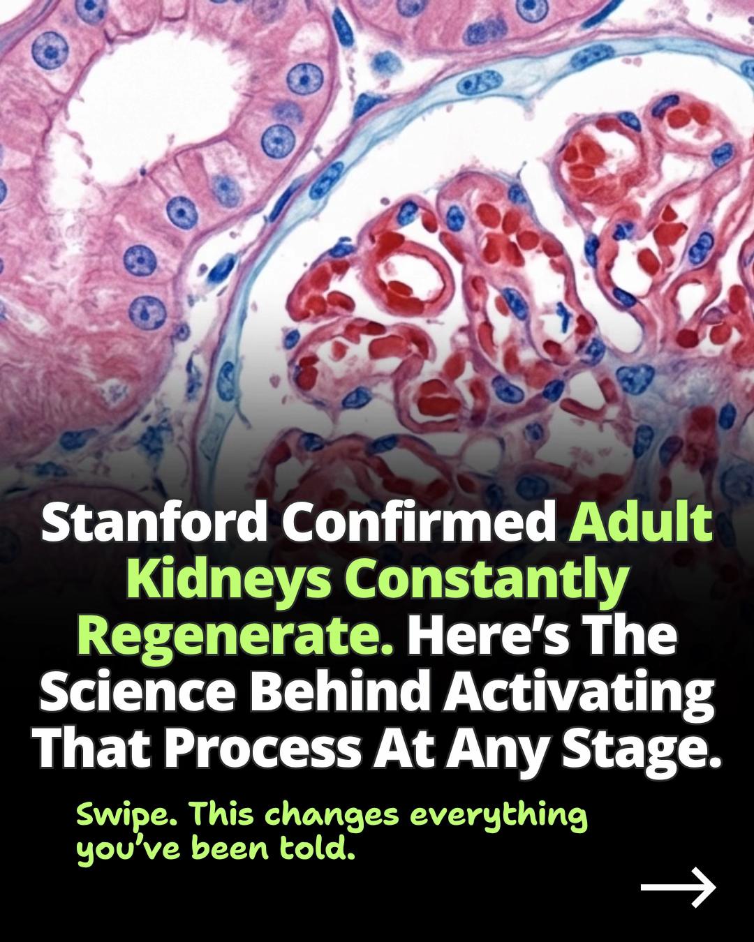 @Kidneysolution