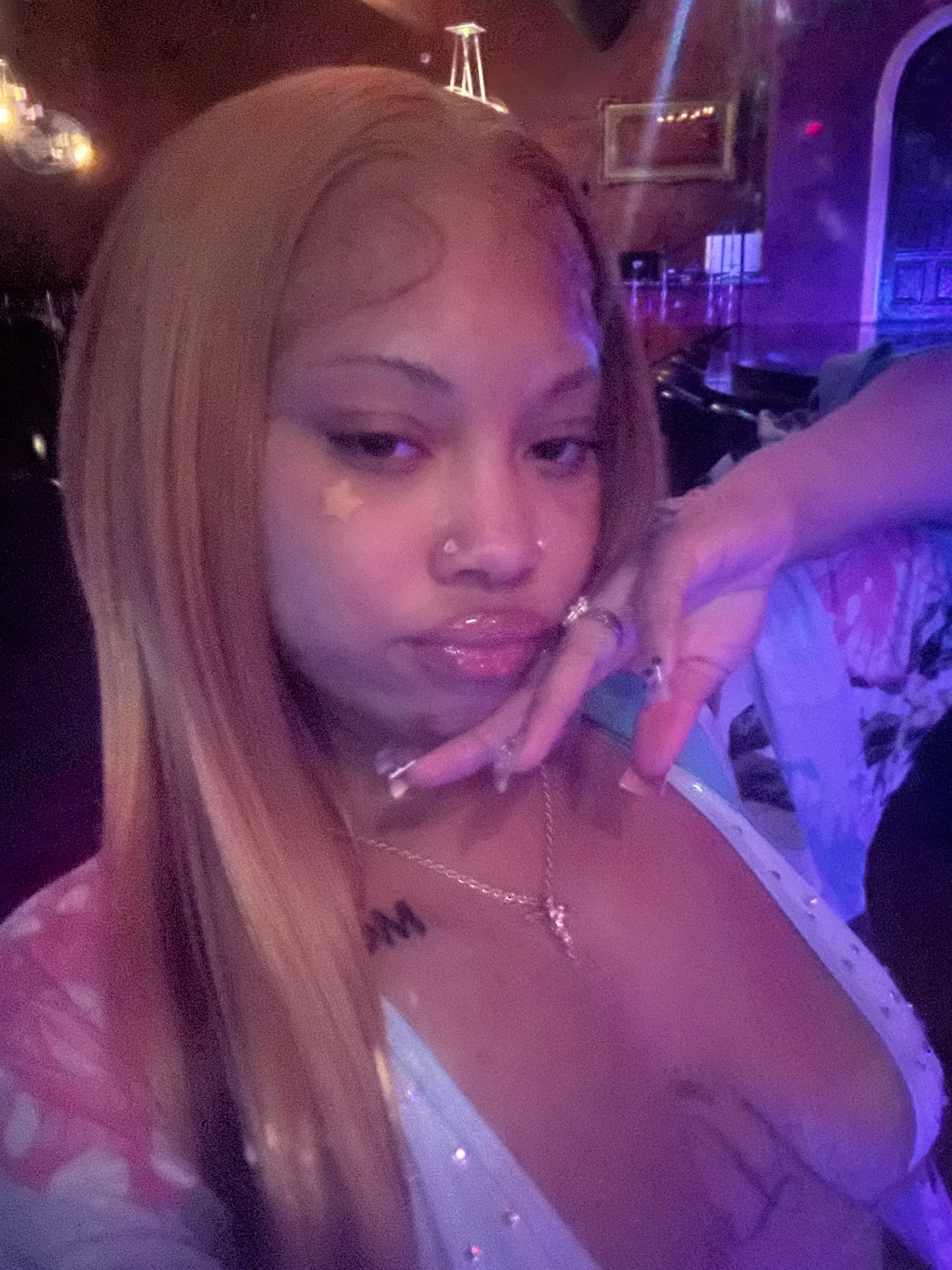 @Redbone
