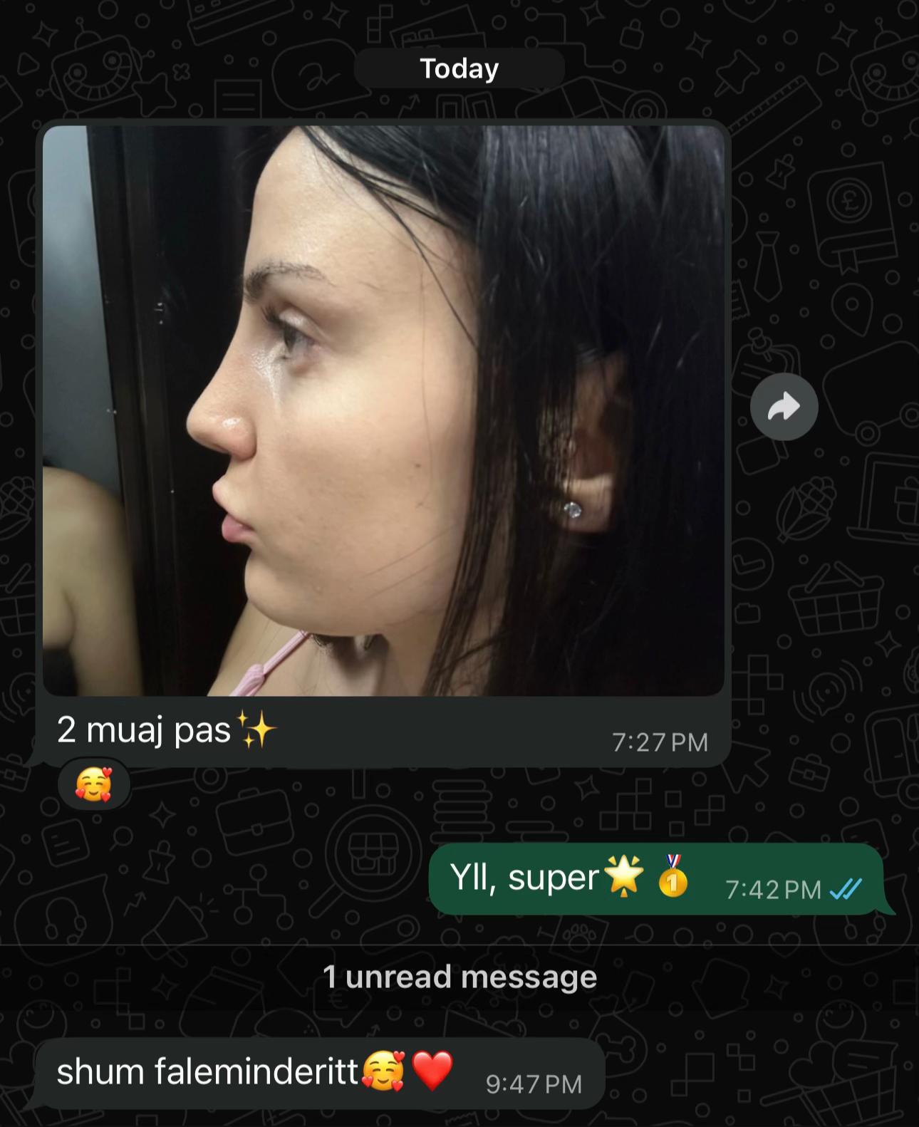 @rinoplasticatirana