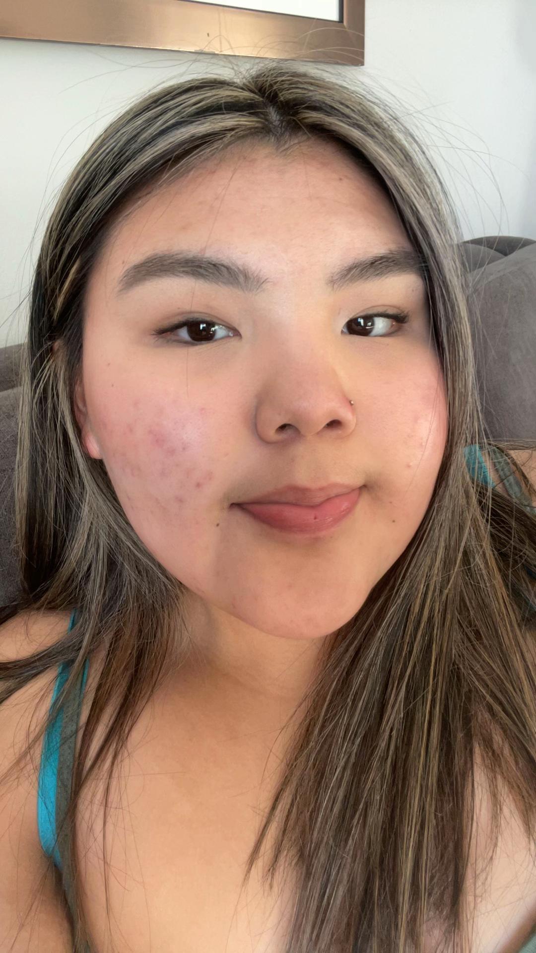 @Kyra