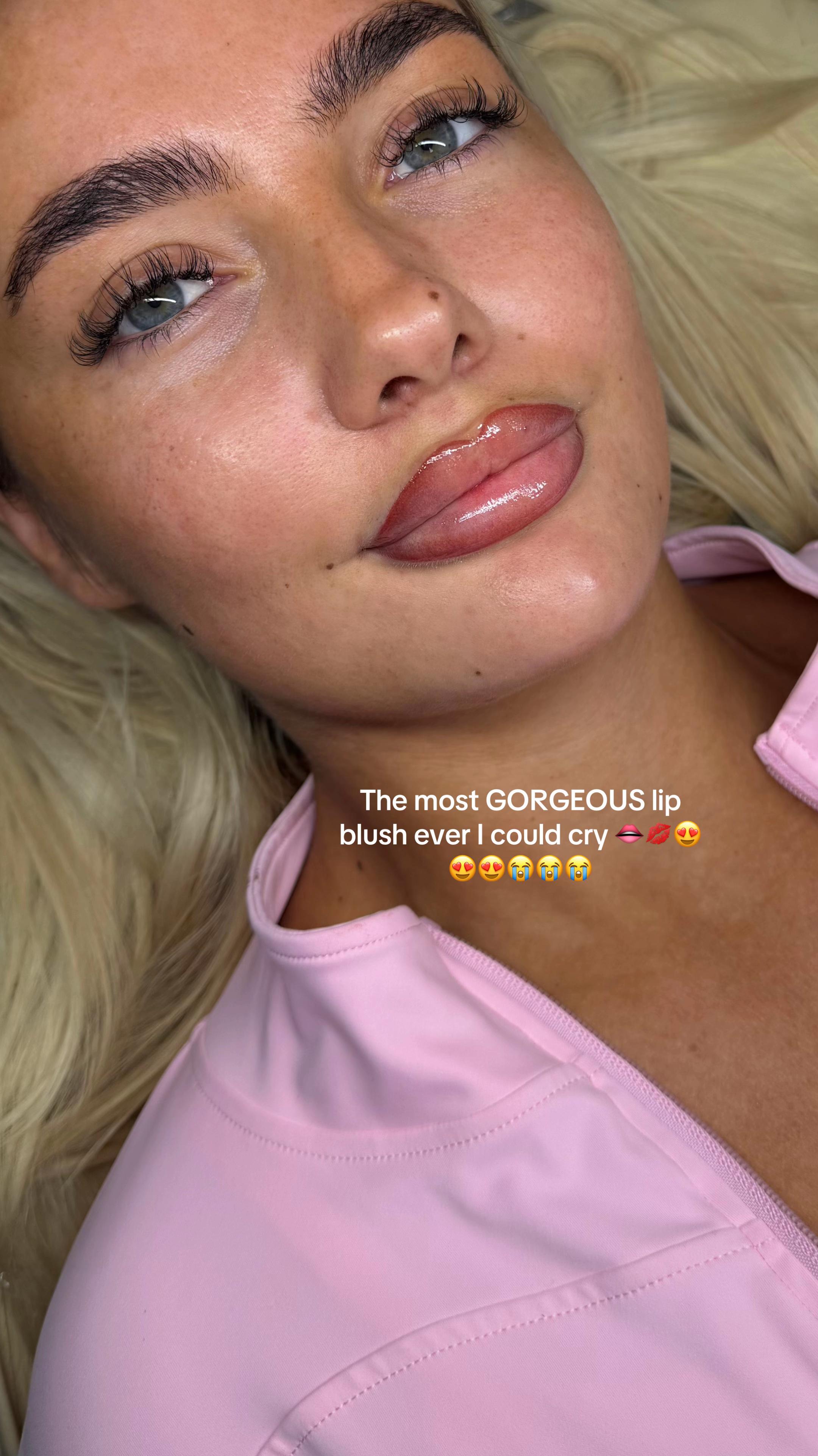 @chlo.snelson