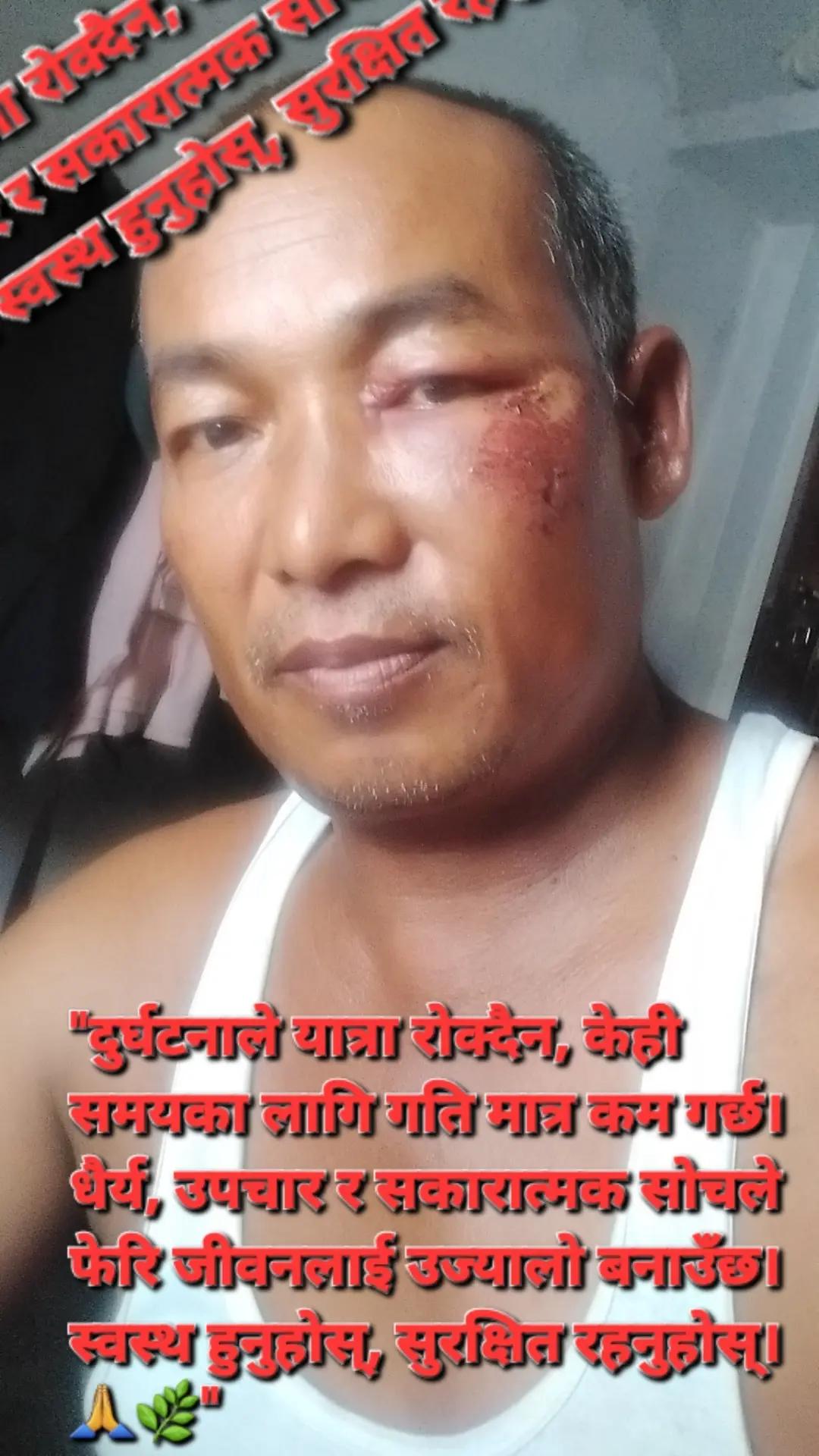 @Surendra prasad Mahato