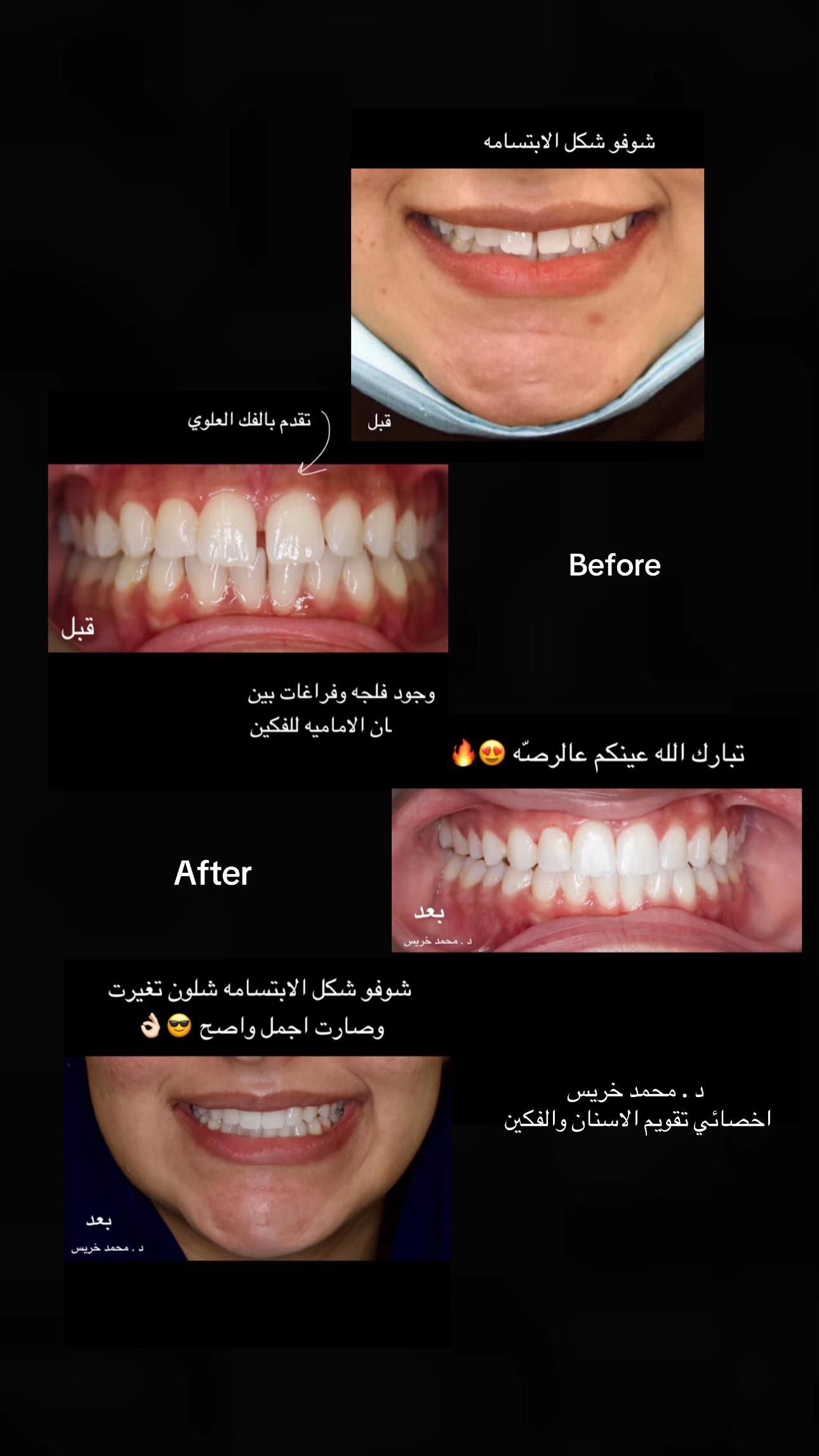 @مركز مزدانه 1 ( فرع الصحافه )