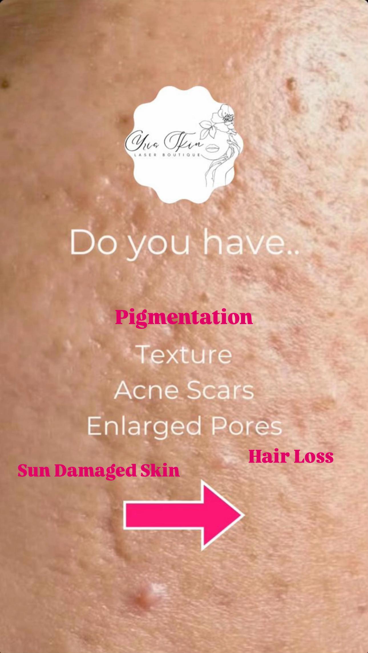 @Yris Skin Laser Boutique Delta