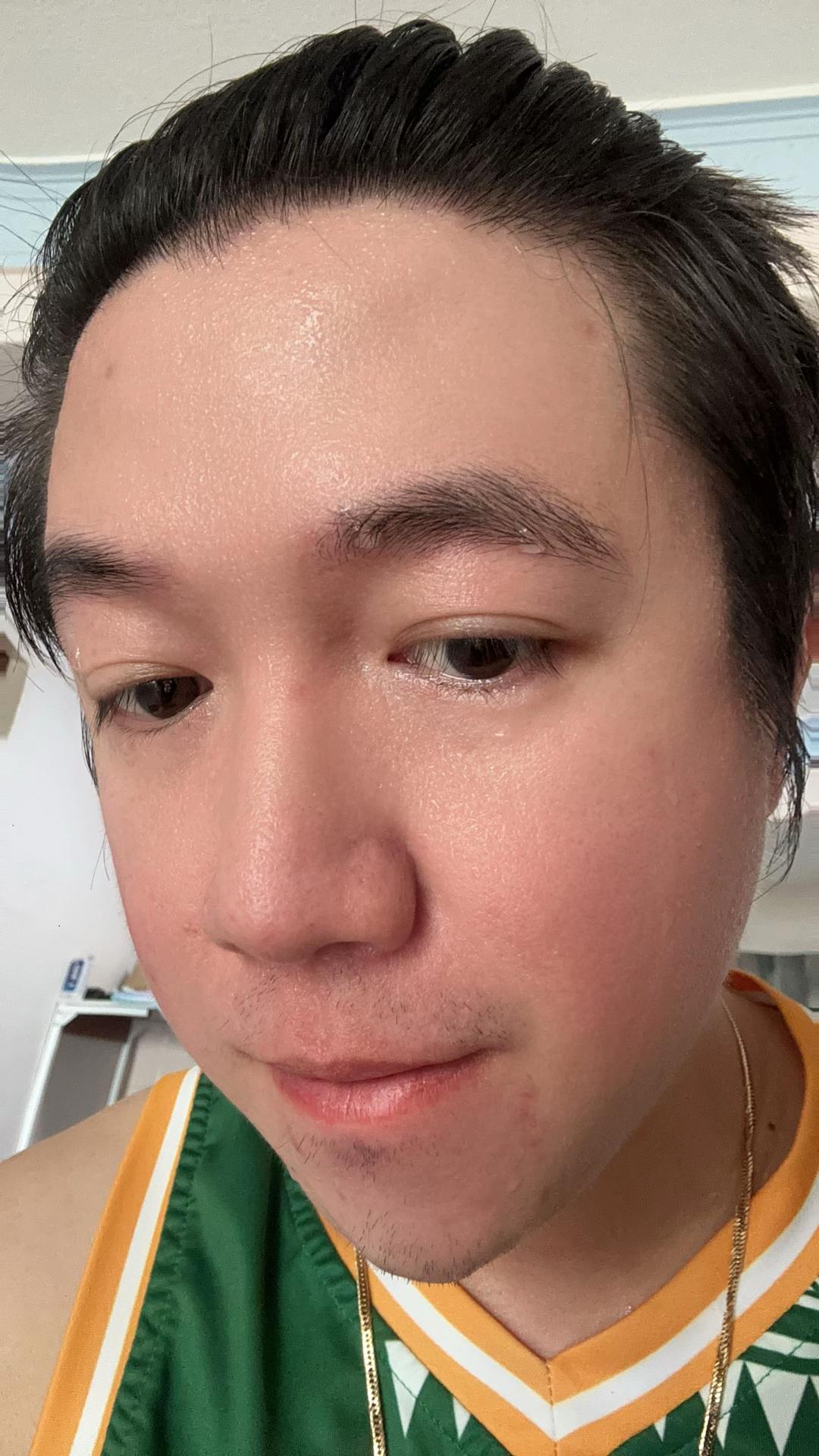@Nurse Elot 🧑🏼&zwj;⚕️🇸🇬