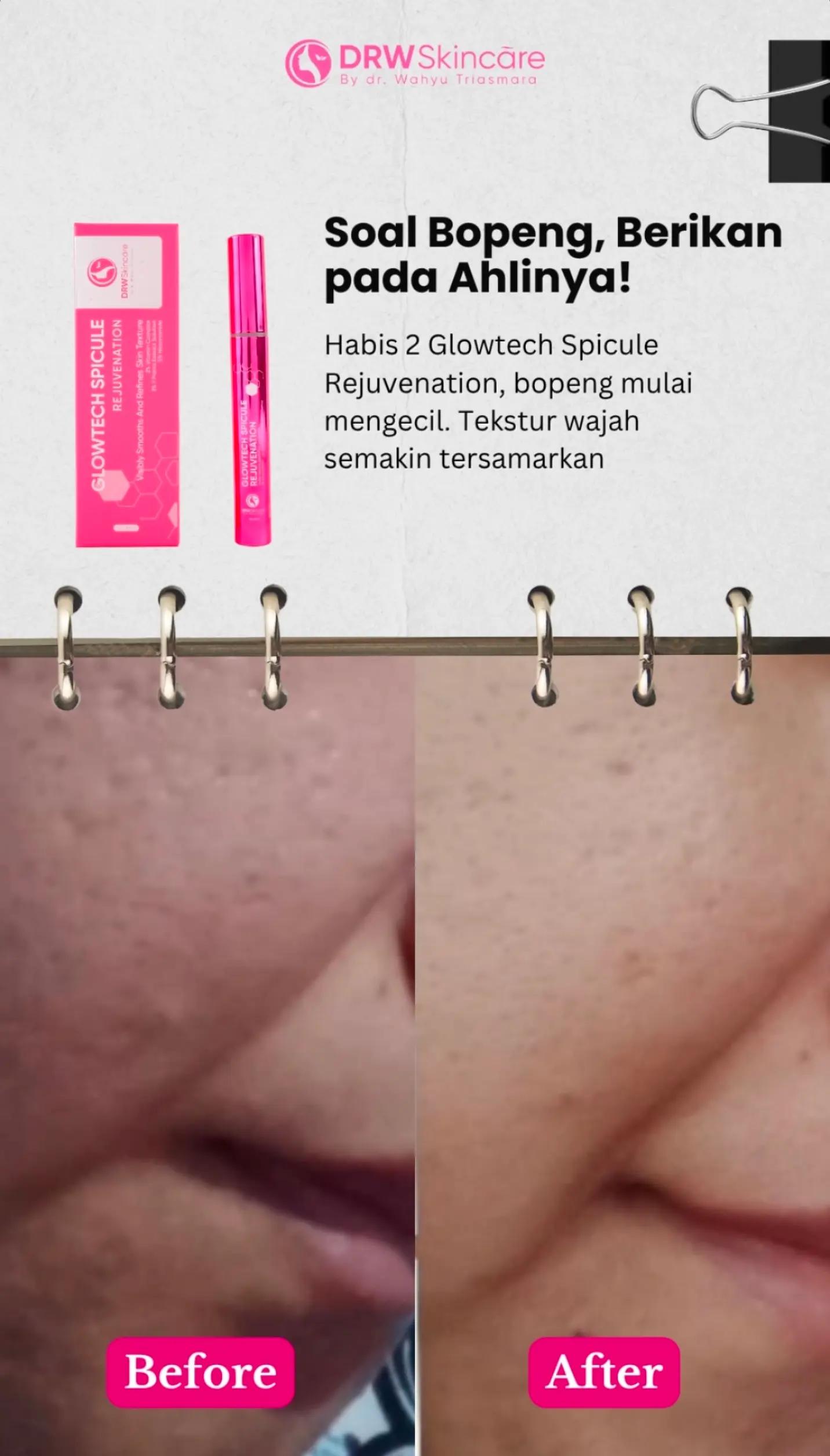 @Drw.Skincare Bali