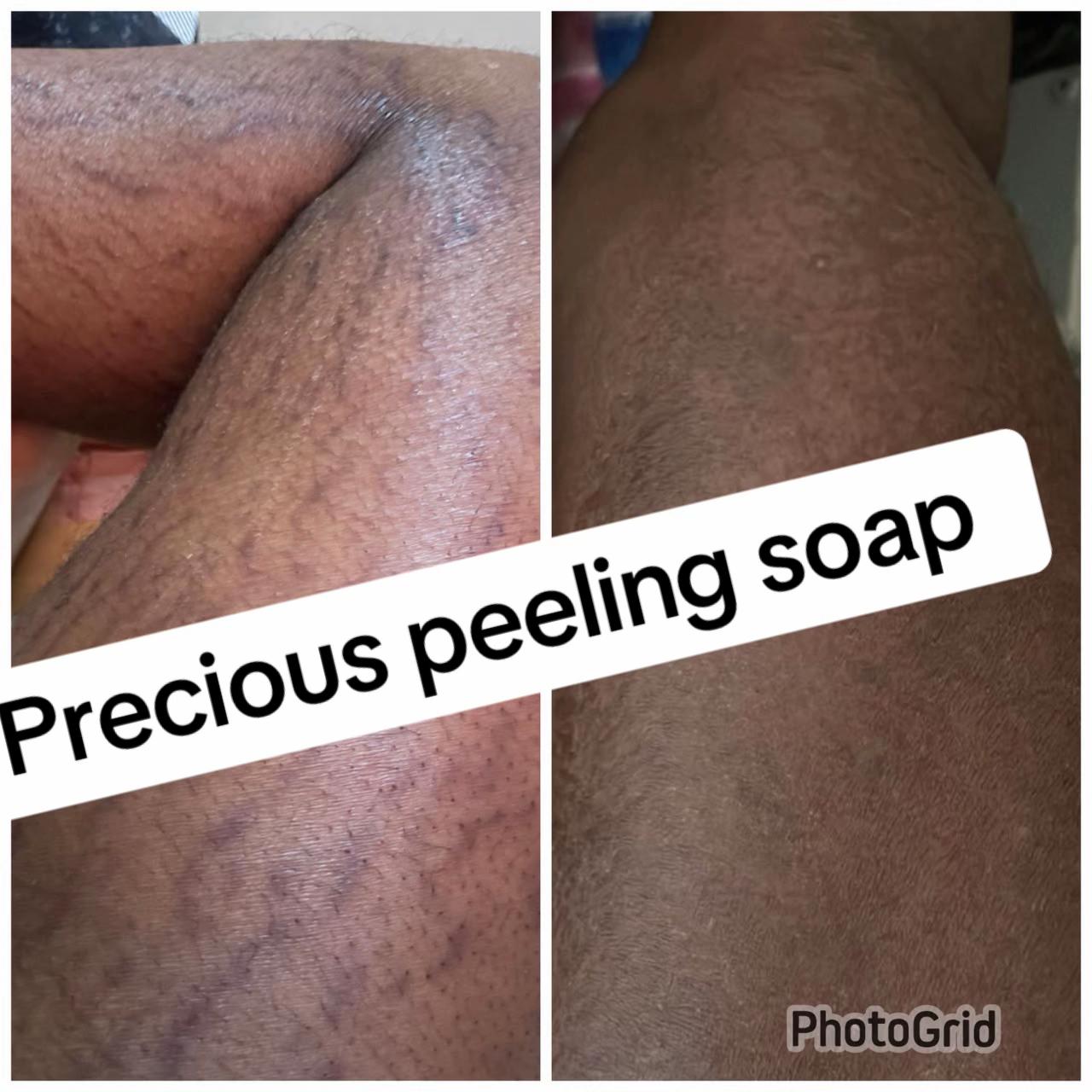 @@ Precious peeling soap