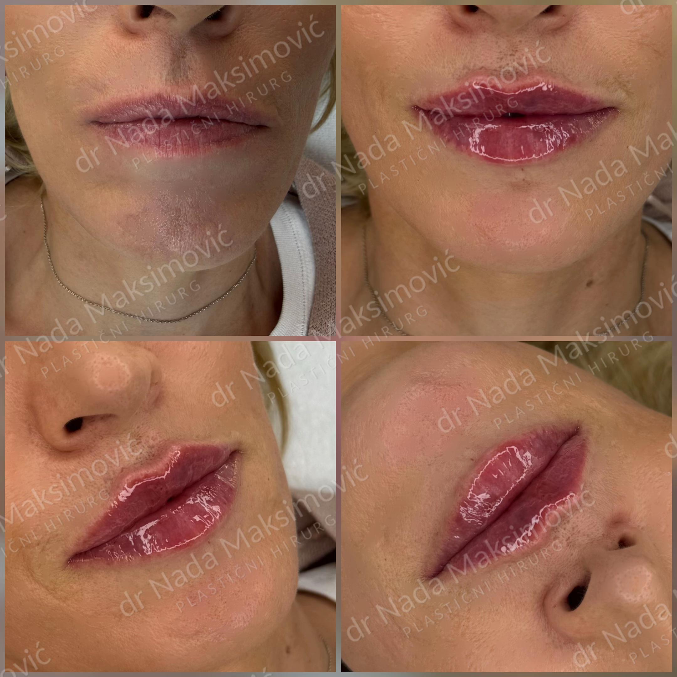 @Dr Nada Maksimovic