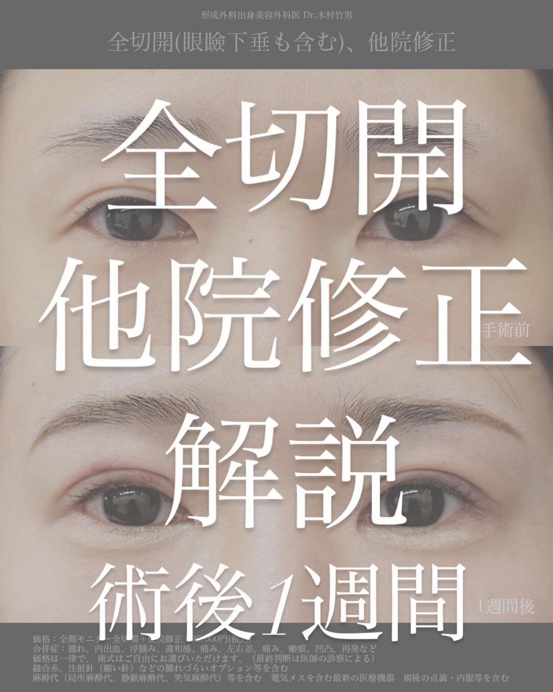 @dr_takeo_kimura