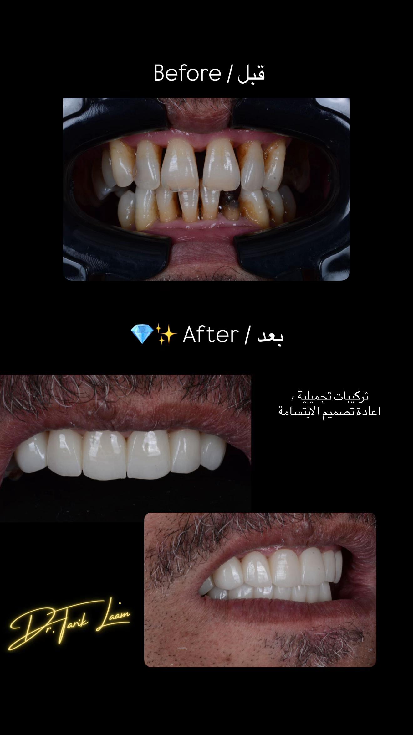 @Dr.tarik_laam