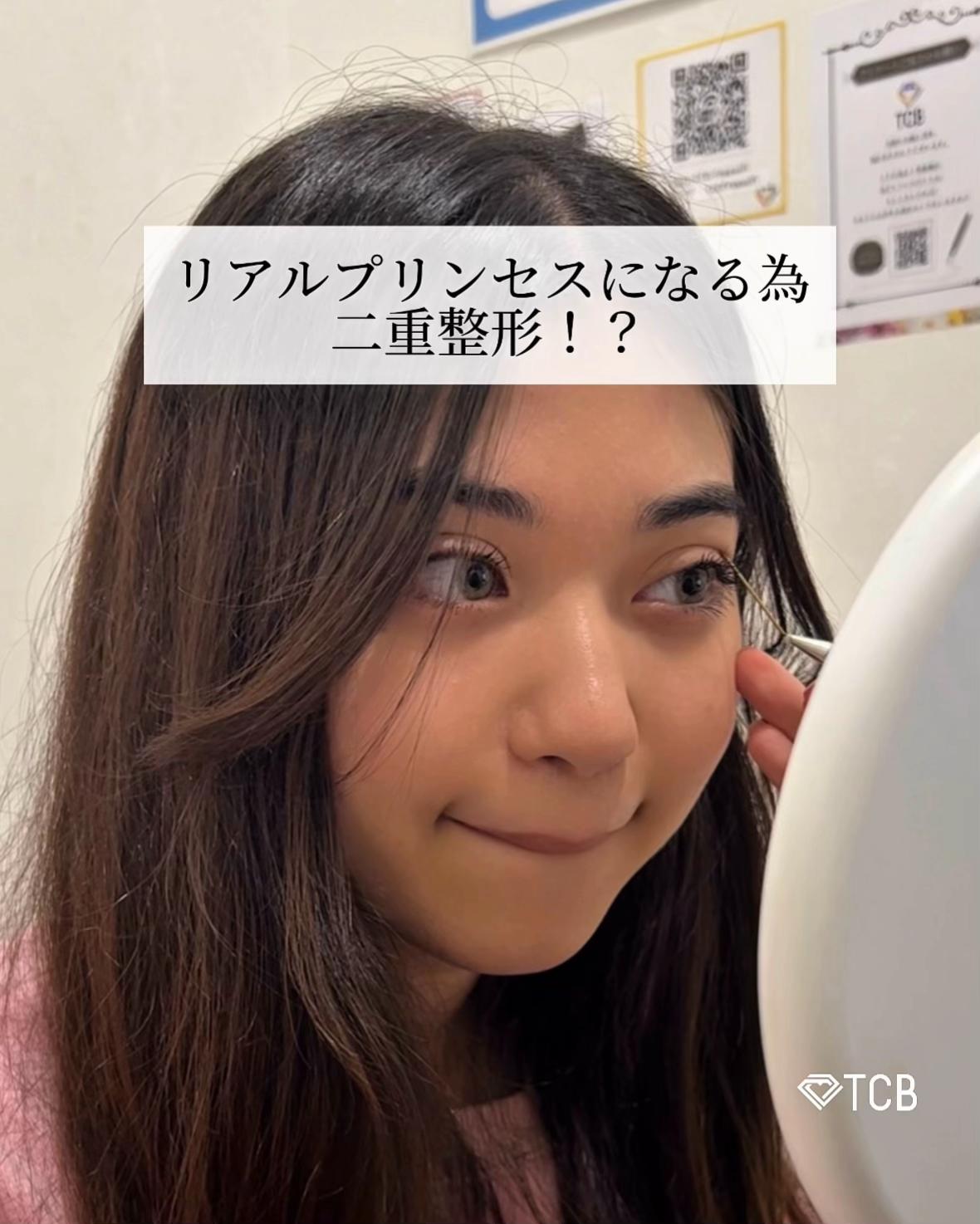 @【二重整形】TCB 新宿東口院ゆいこ先生/東京