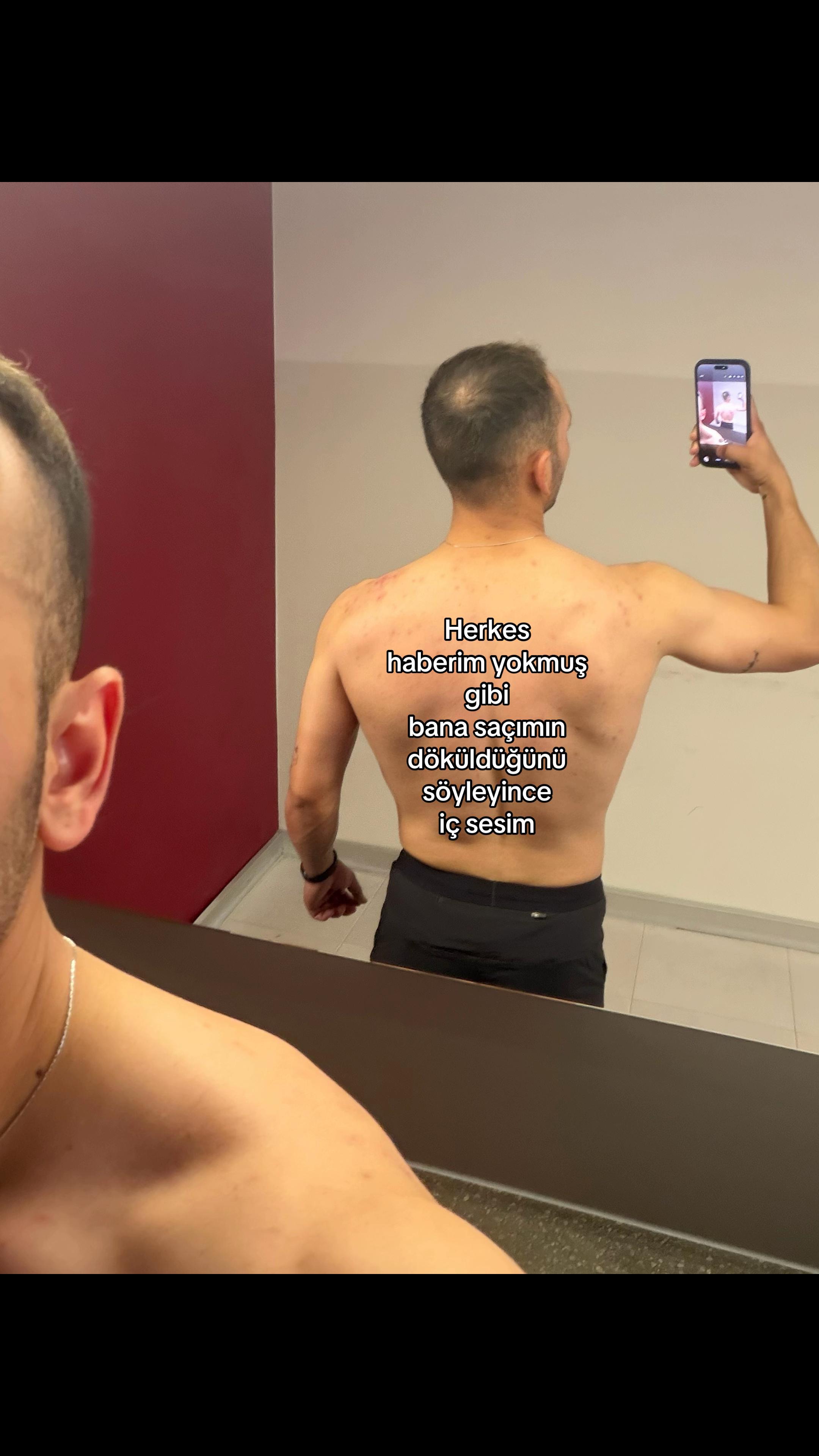 @Unooo