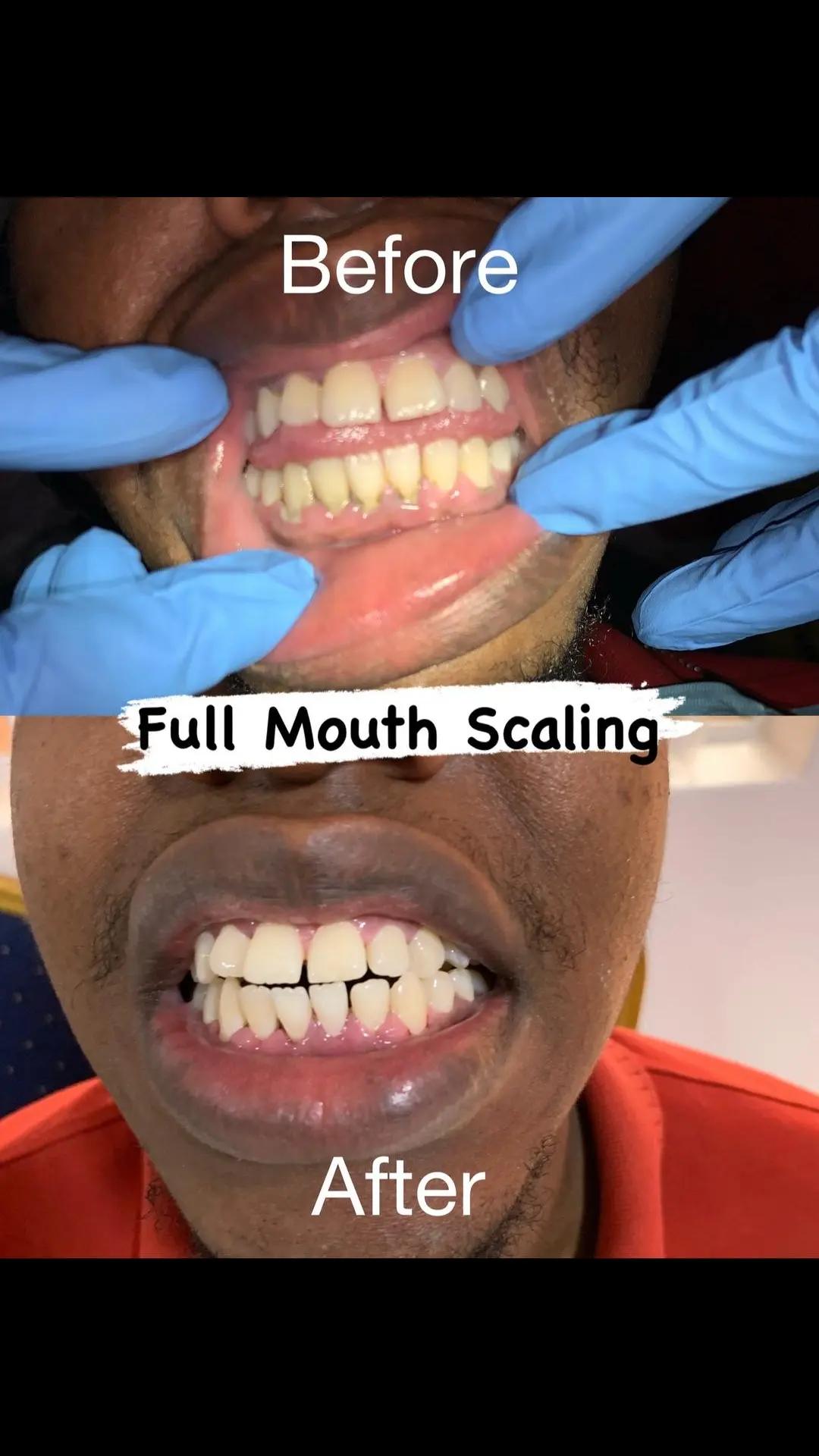 @SMILES