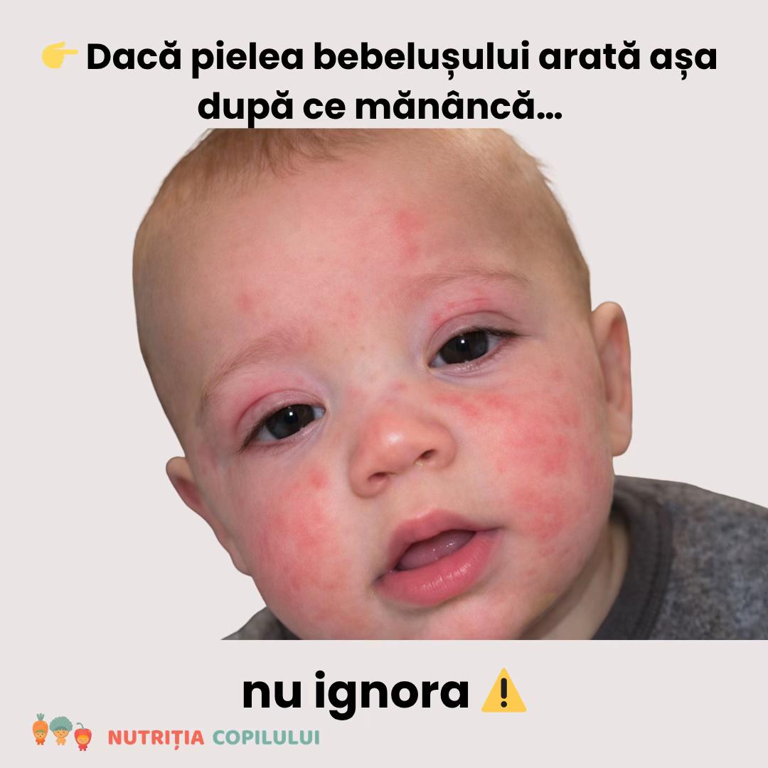 @Nutritia Copilului