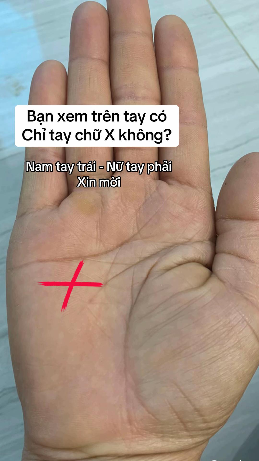 @VẬN MỆNH RADIO