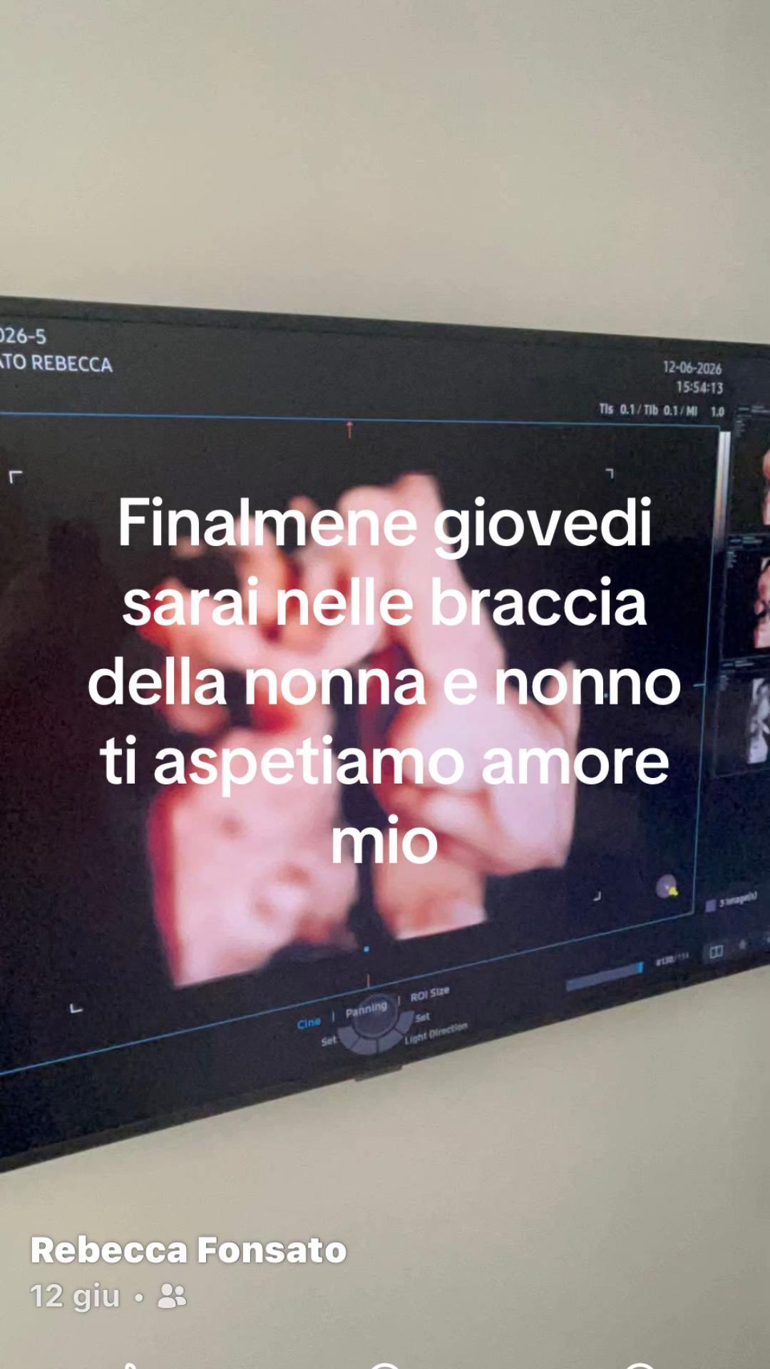 @Iolanda Ballarin