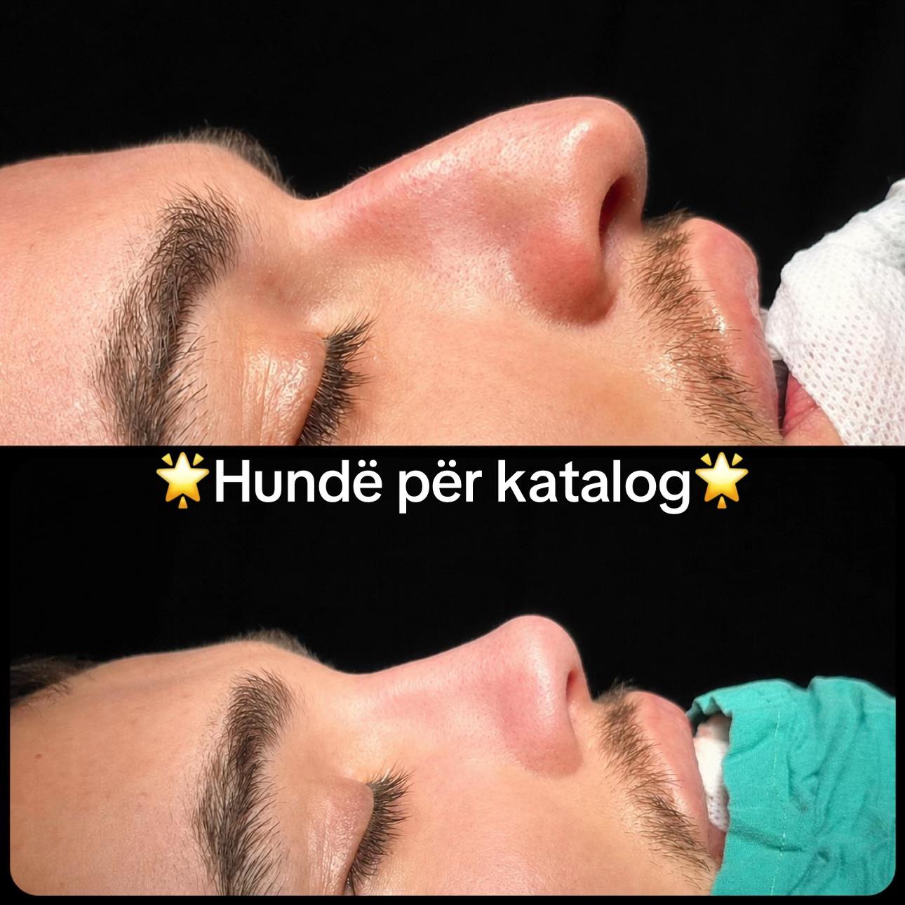 @rinoplasticatirana