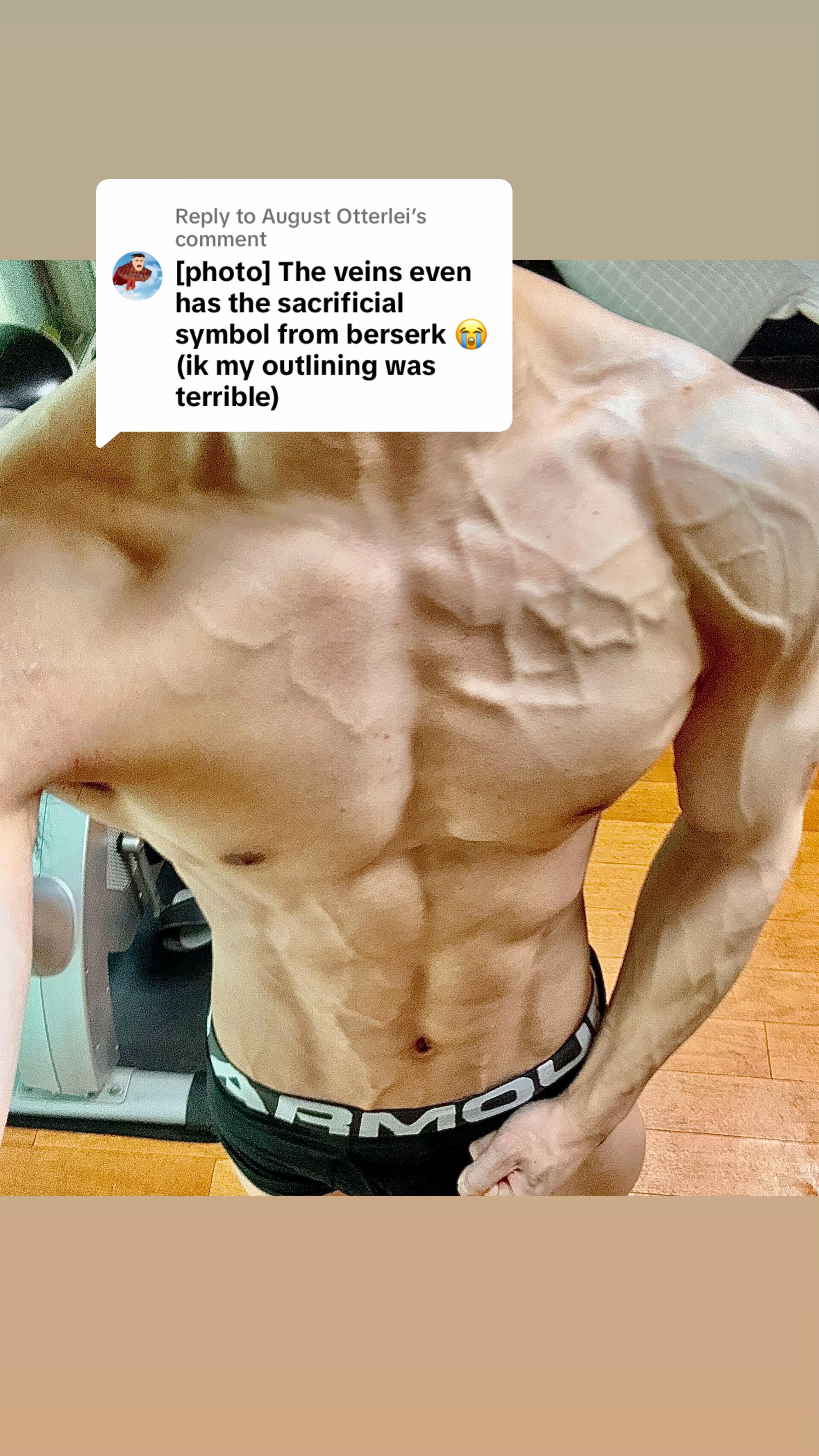 @VINTRX