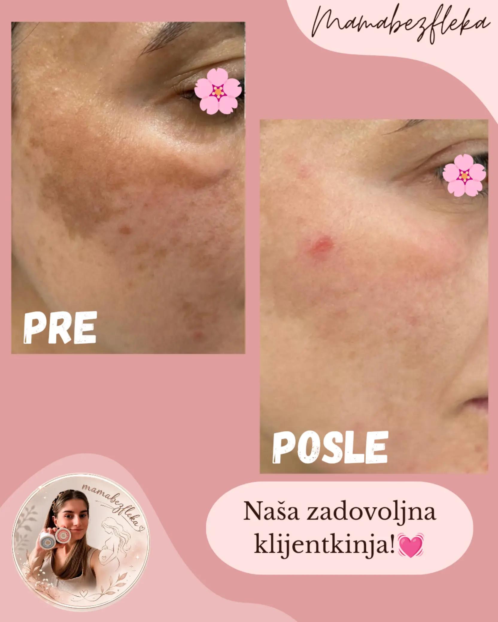 @Mama bez fleka