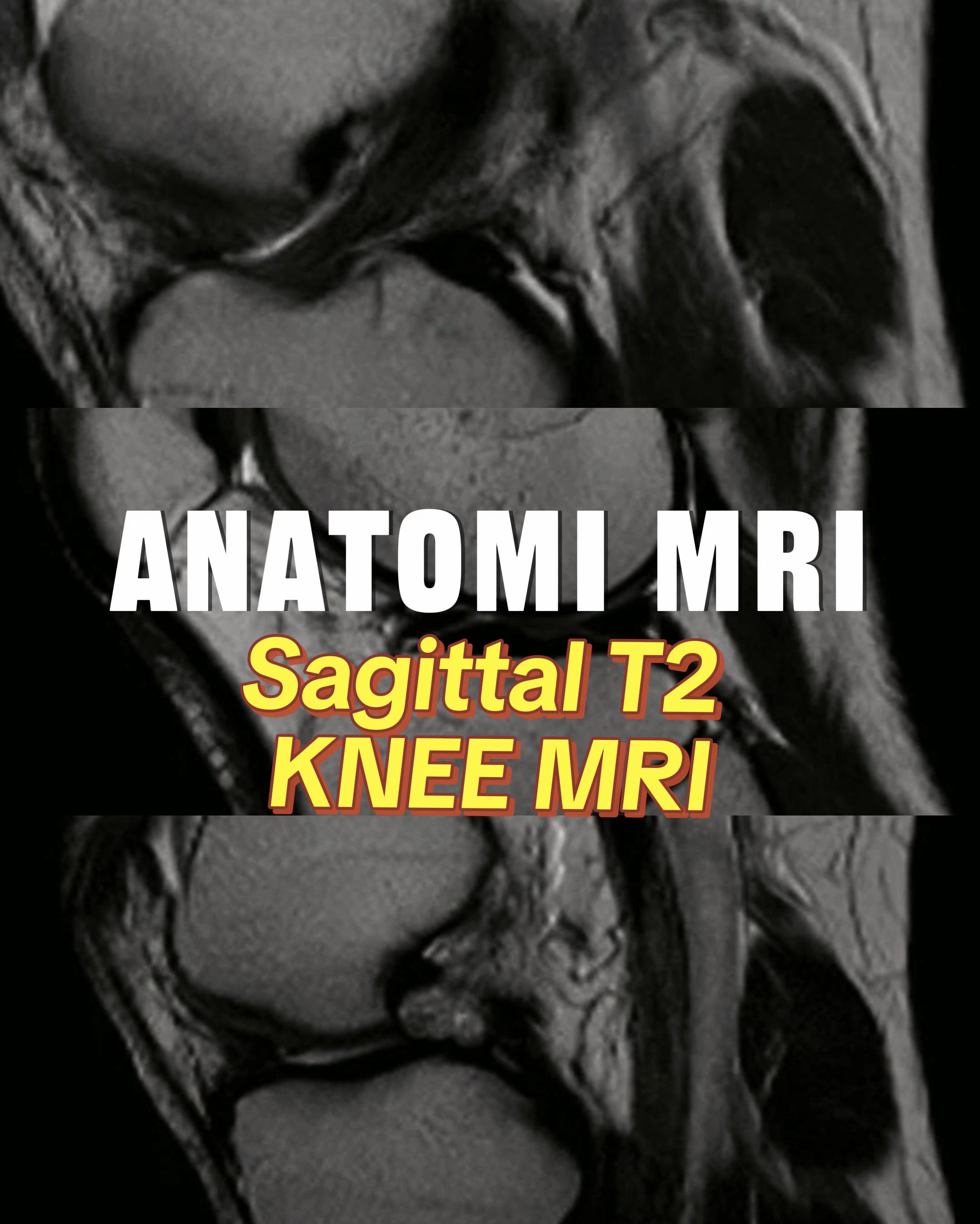 @Sobat Radiology