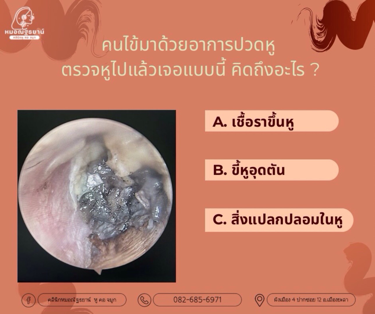 @คลินิกหมอณัฐธยาน์ หู คอ จมูก