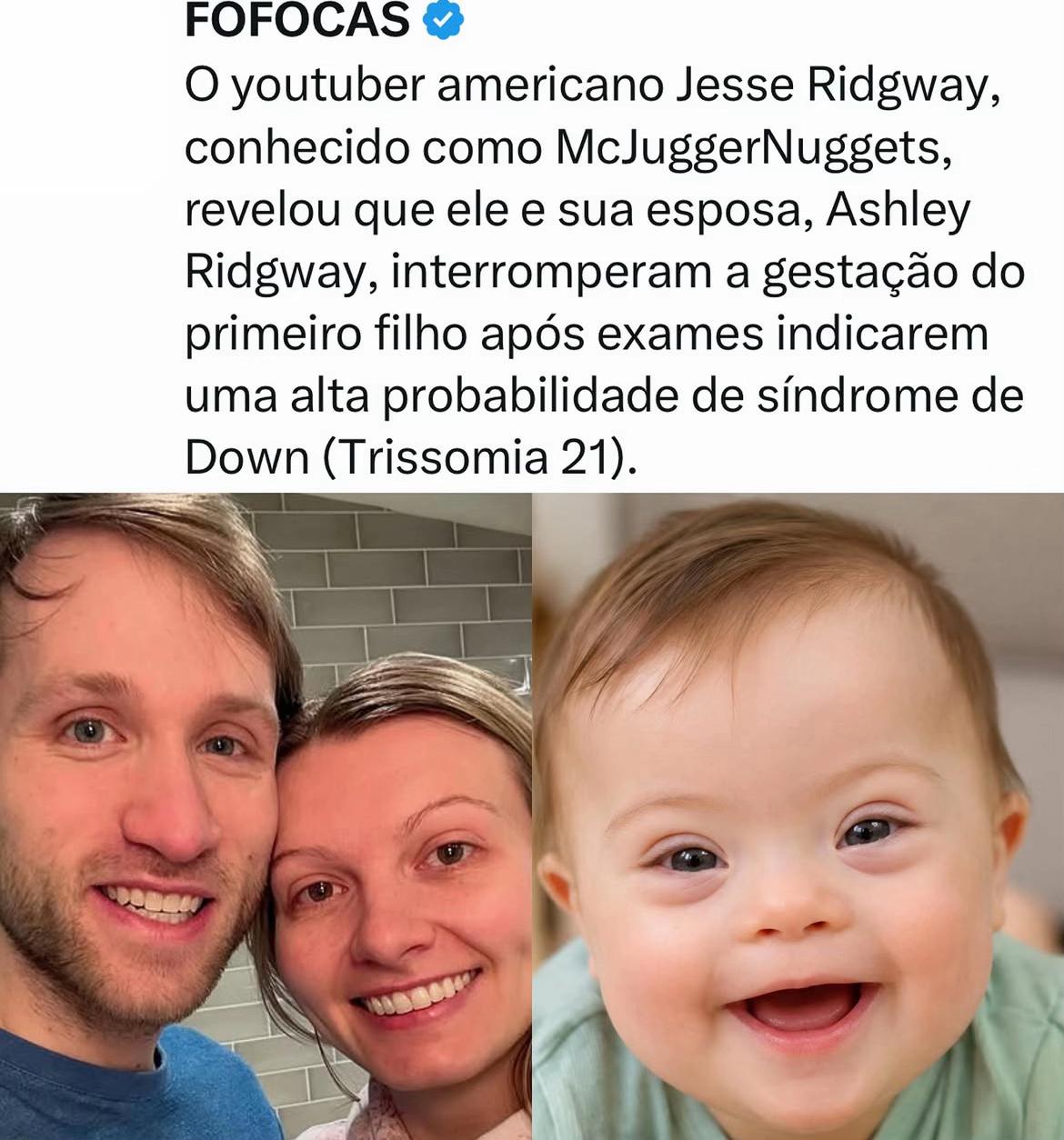 @FOFOCALIZANDO