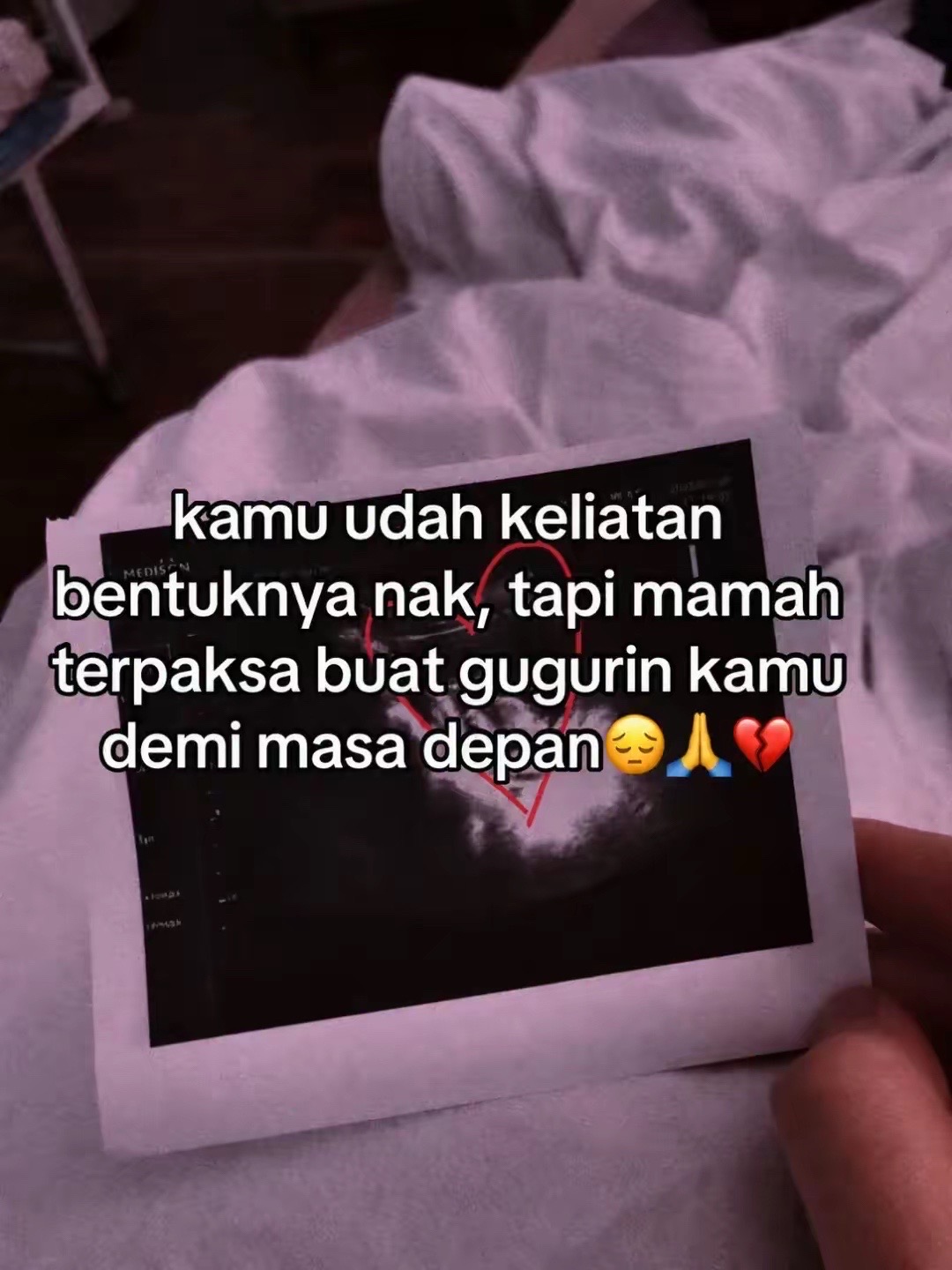 @Riska Saputri