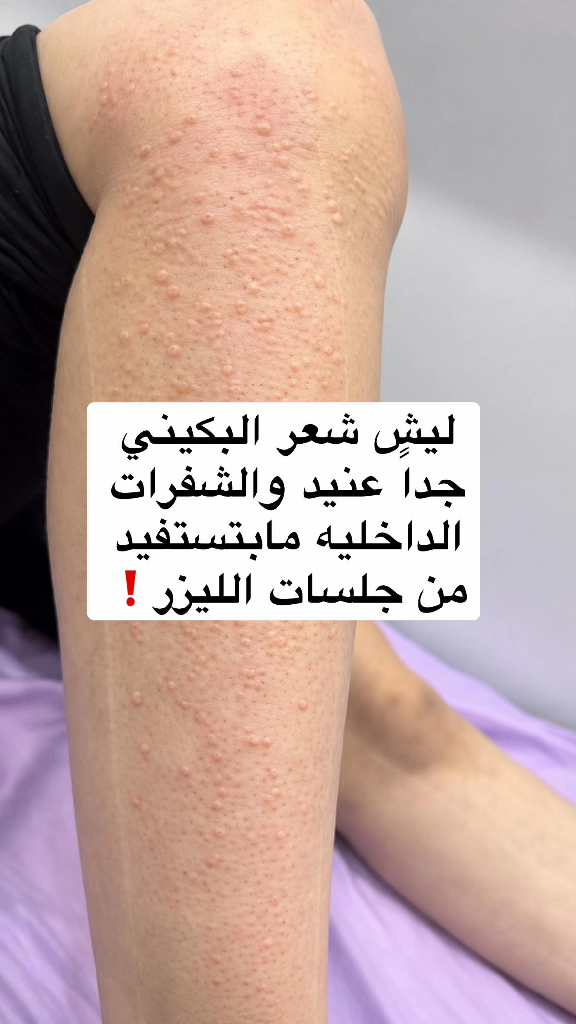 @عيادات بيست كلينك