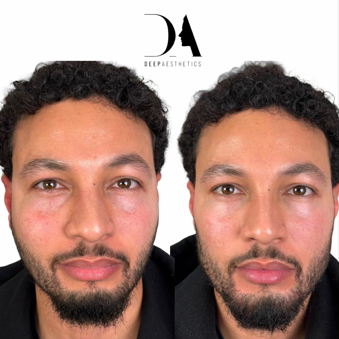 @deepaesthetics_official