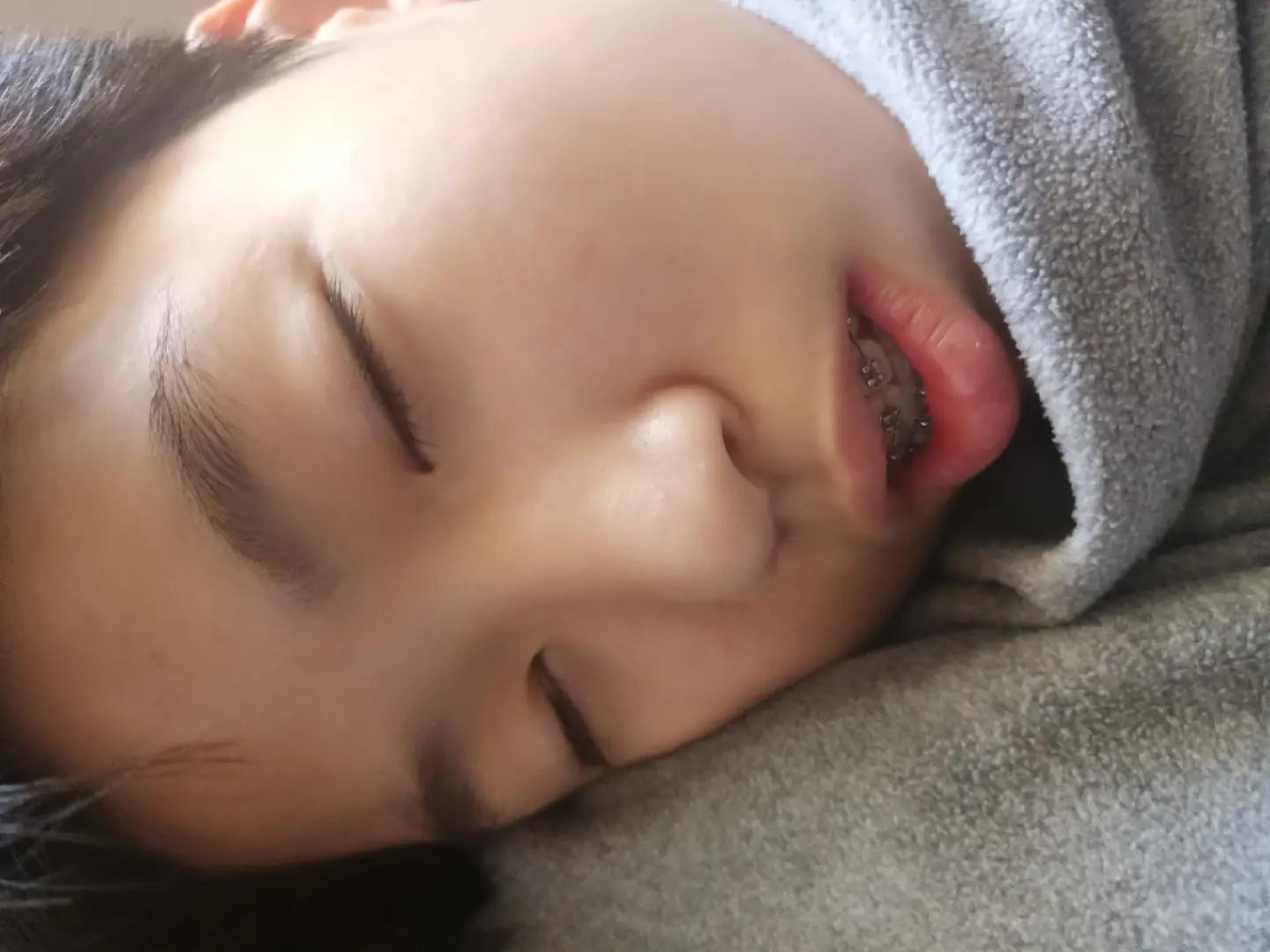@ăn u ăn ặc