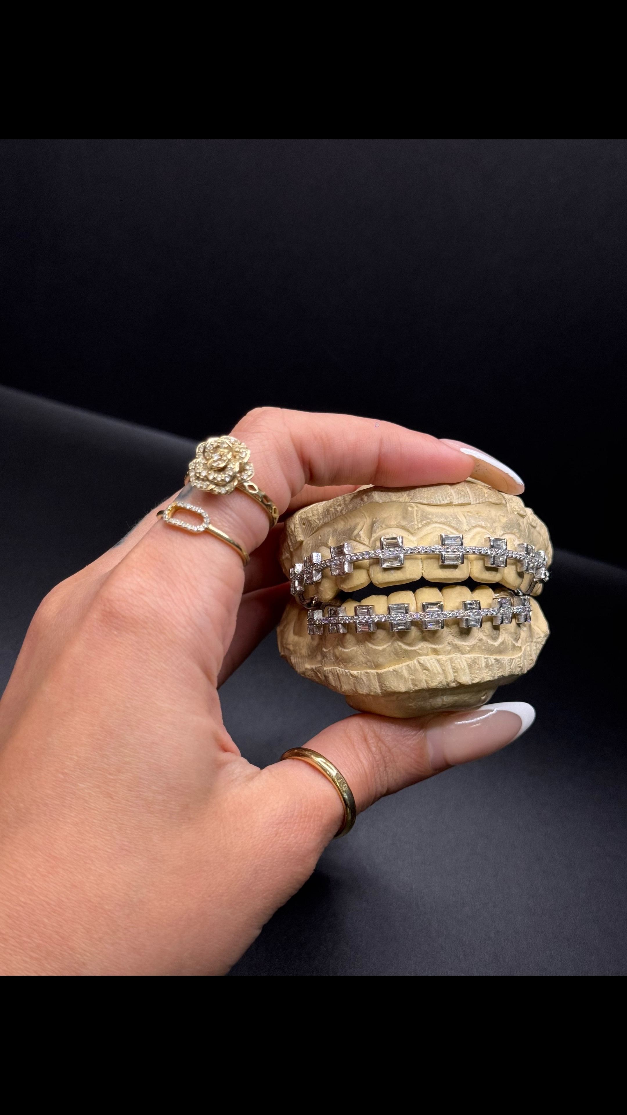 @Gold Custom