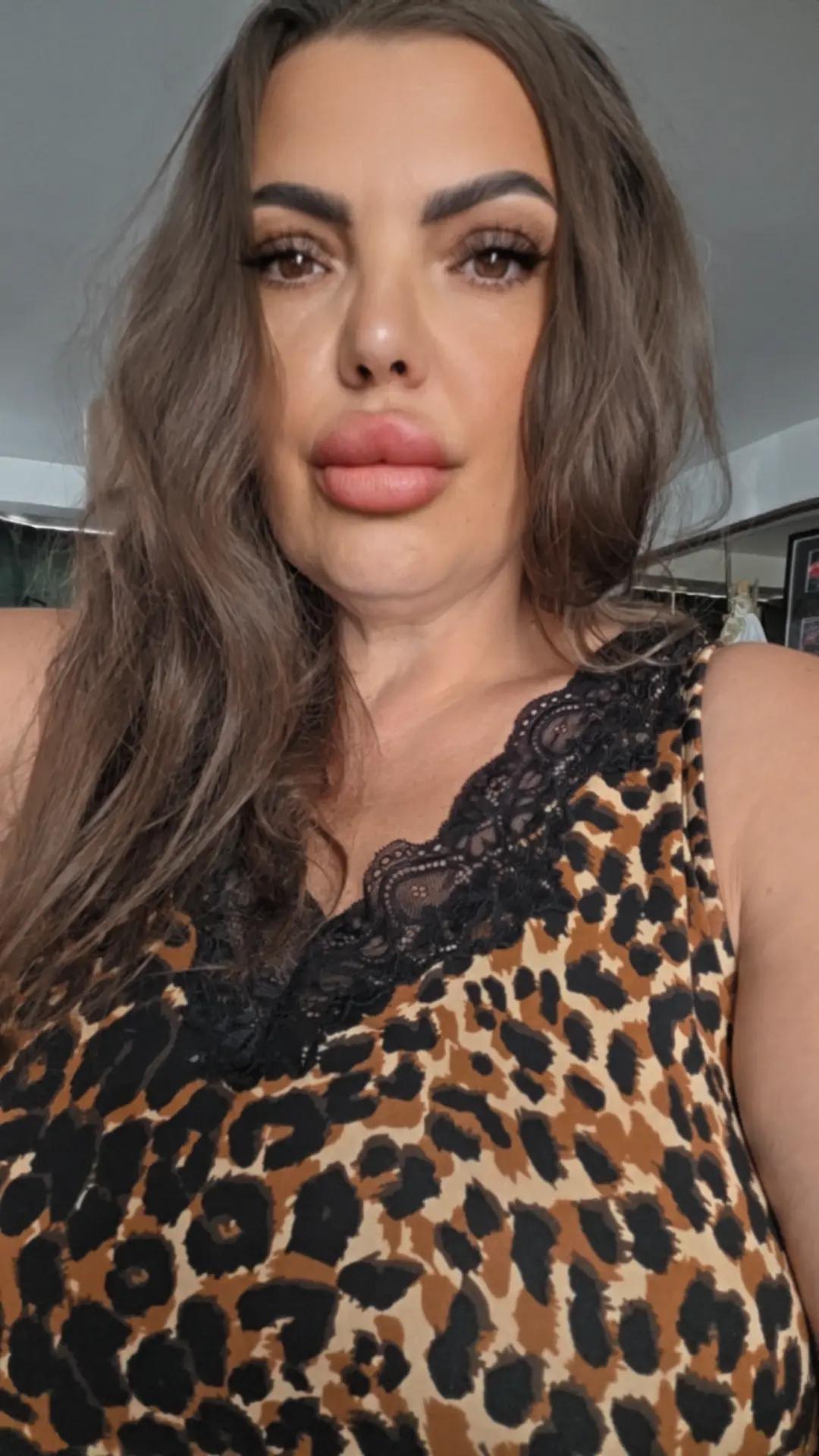 @direnaslan