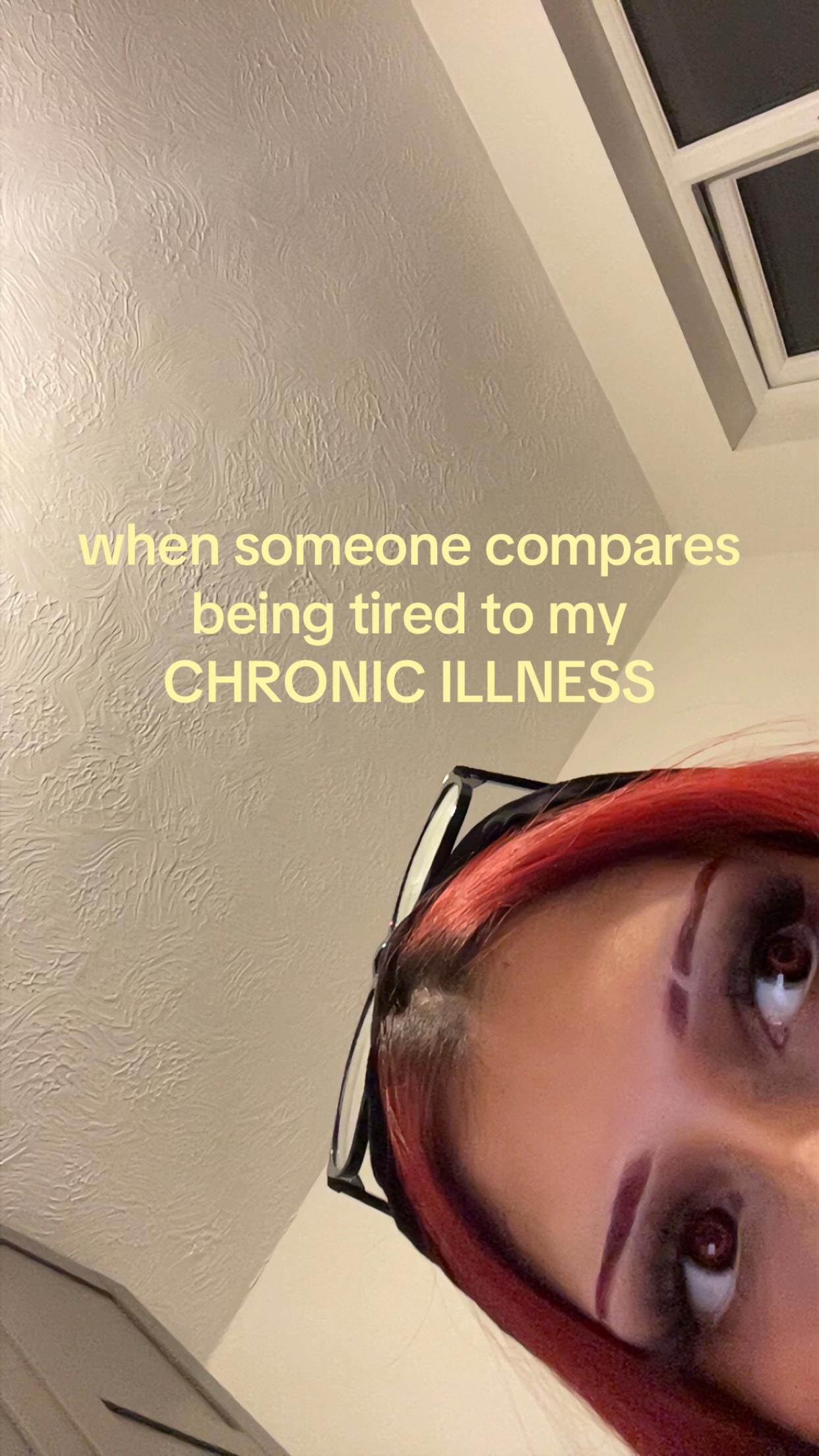 @Sabs