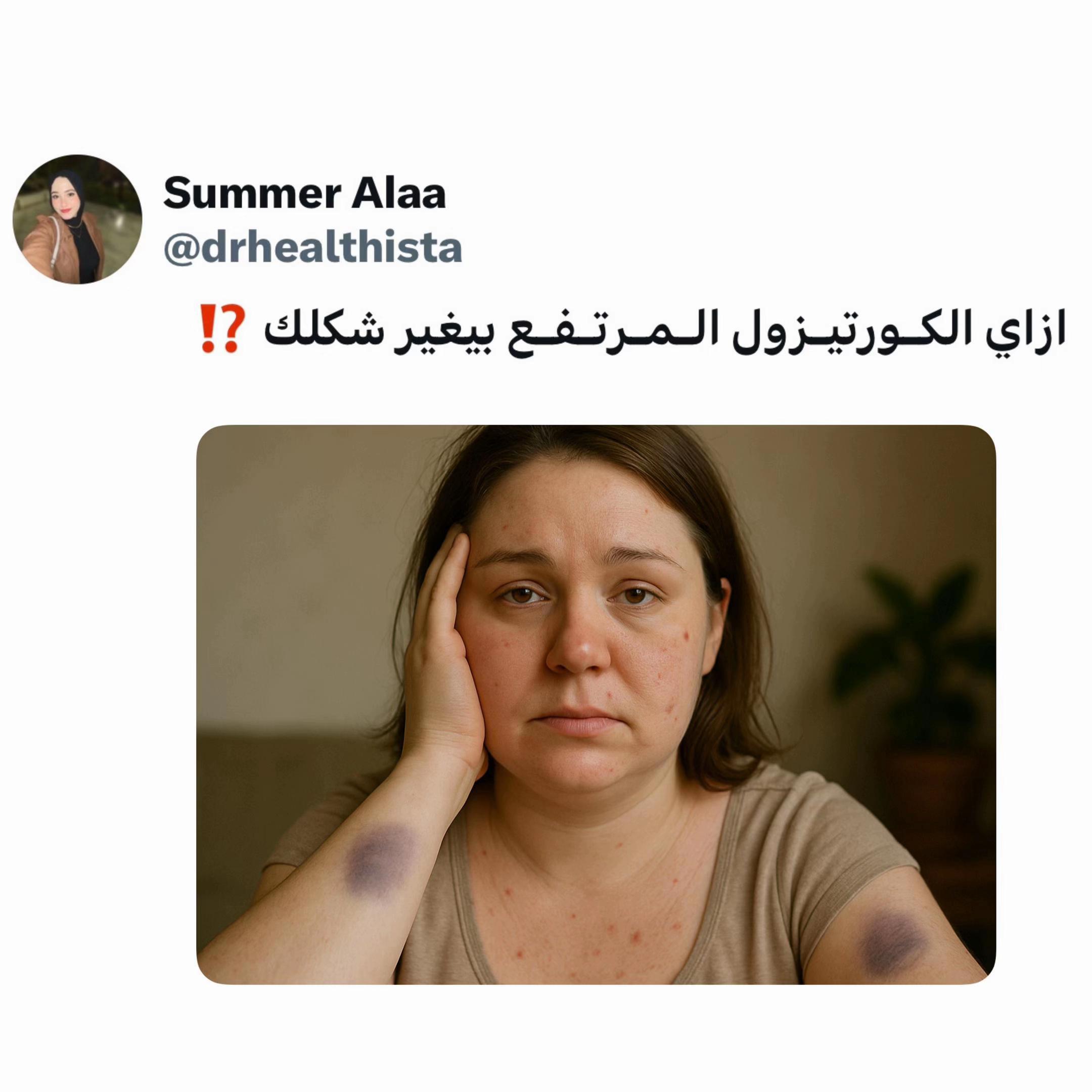 @Dr Summer Alaa | Msc,