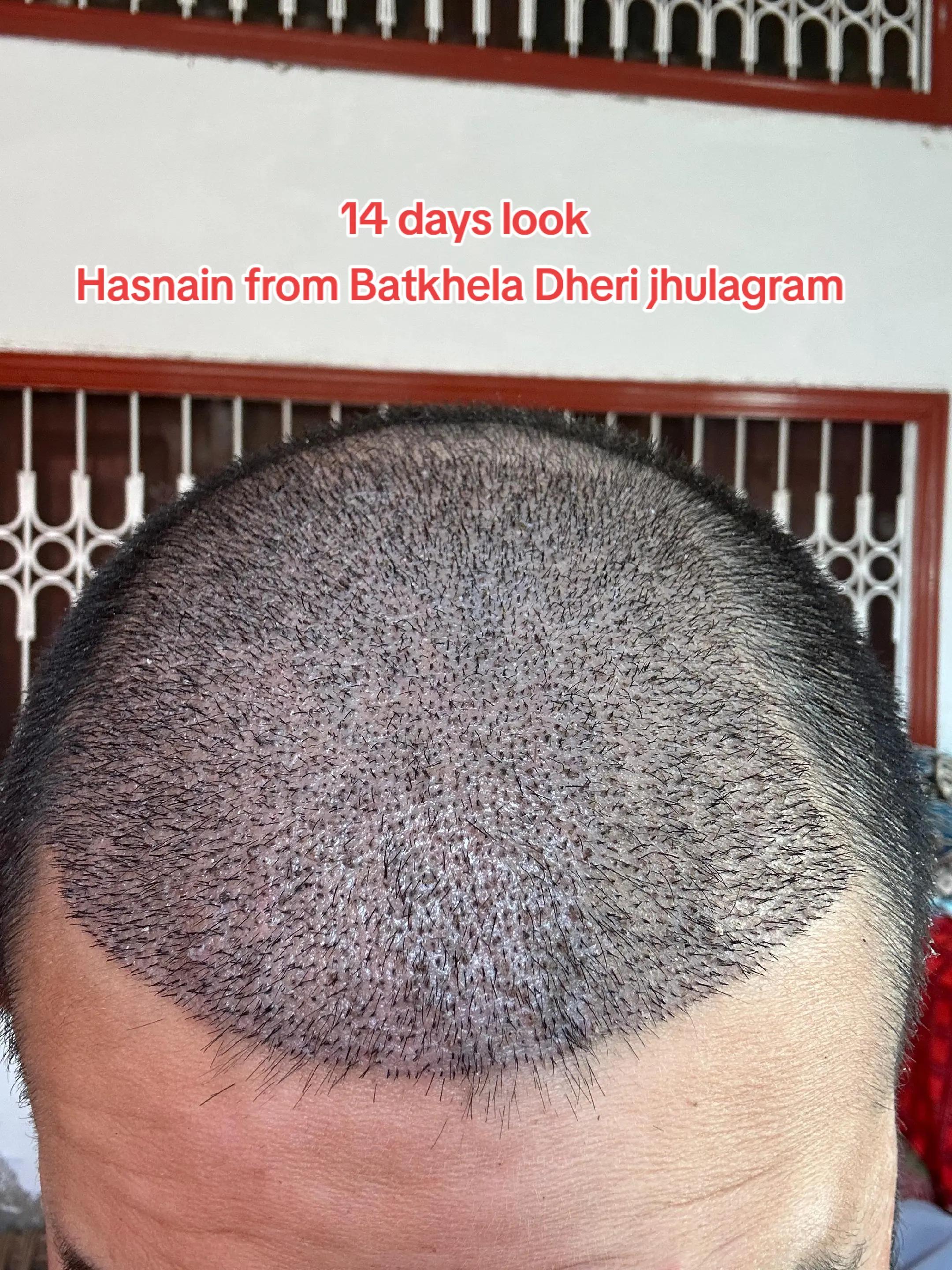 @Dr Asad shalman