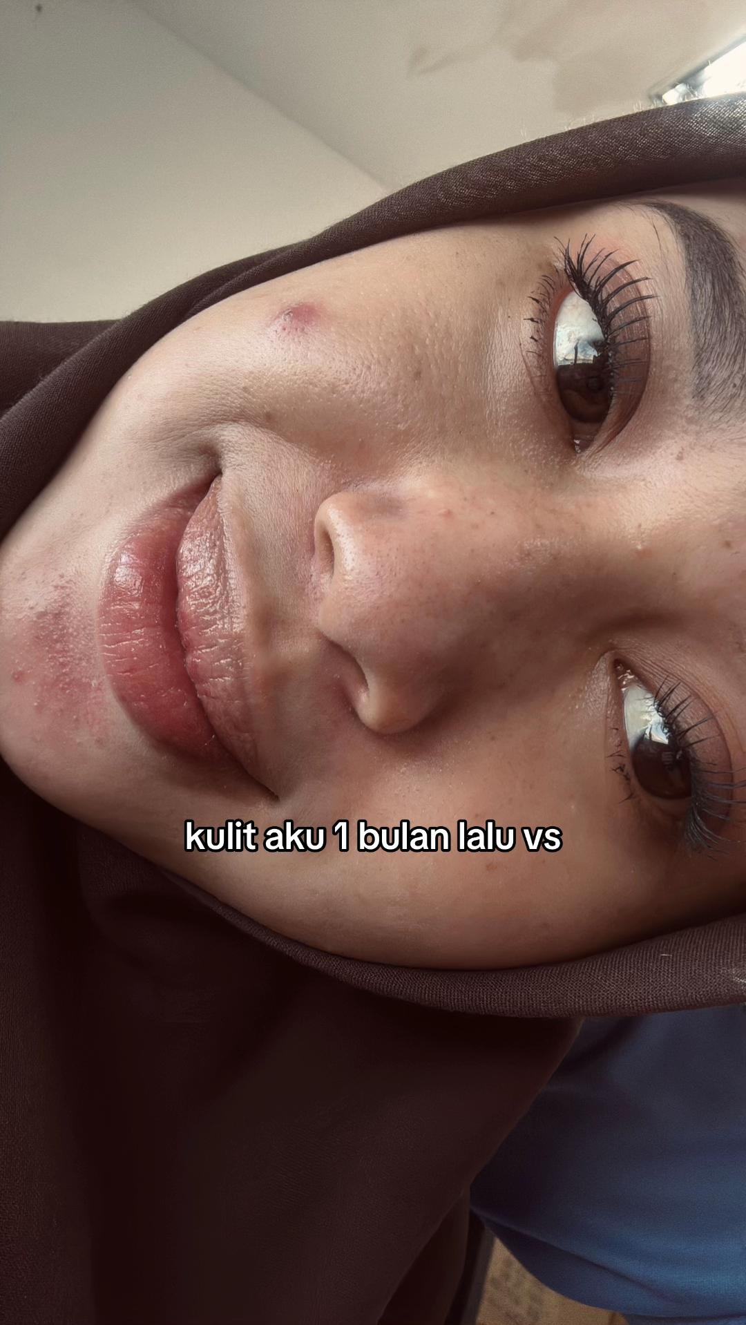 @dekgaluh