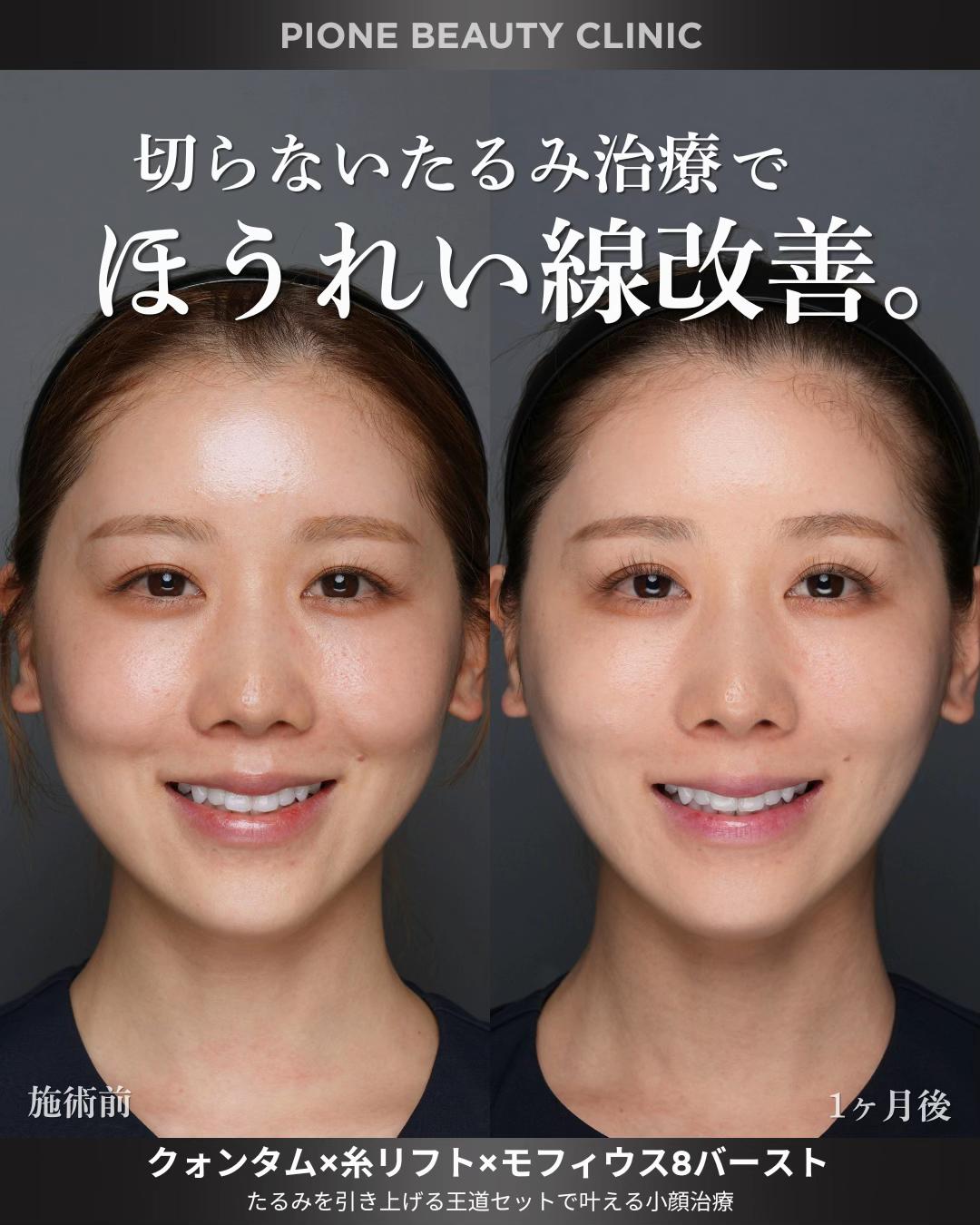 @金澤紀臣【小顔/若返り/脂肪吸引】