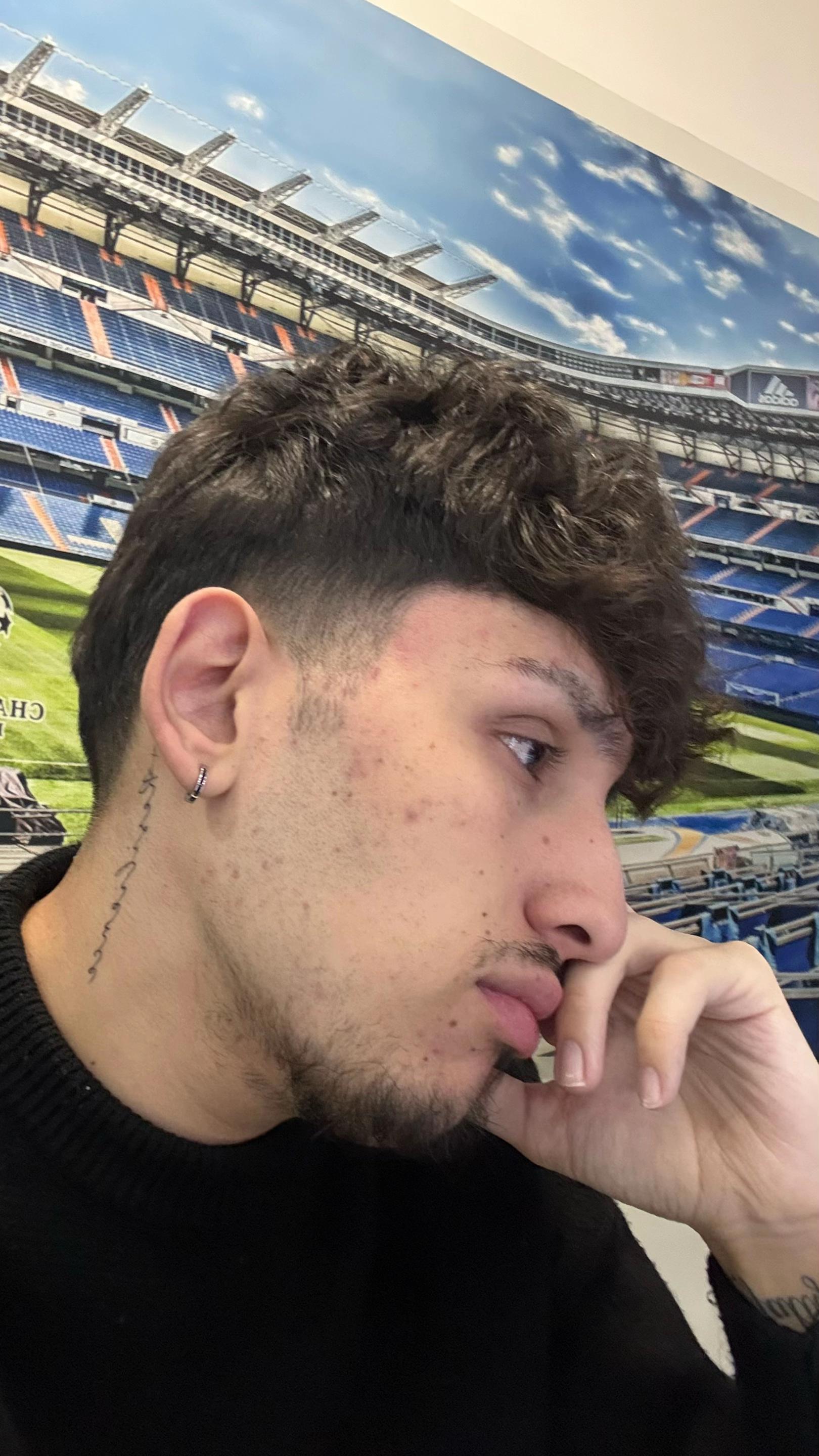 @A L E X 🕷️