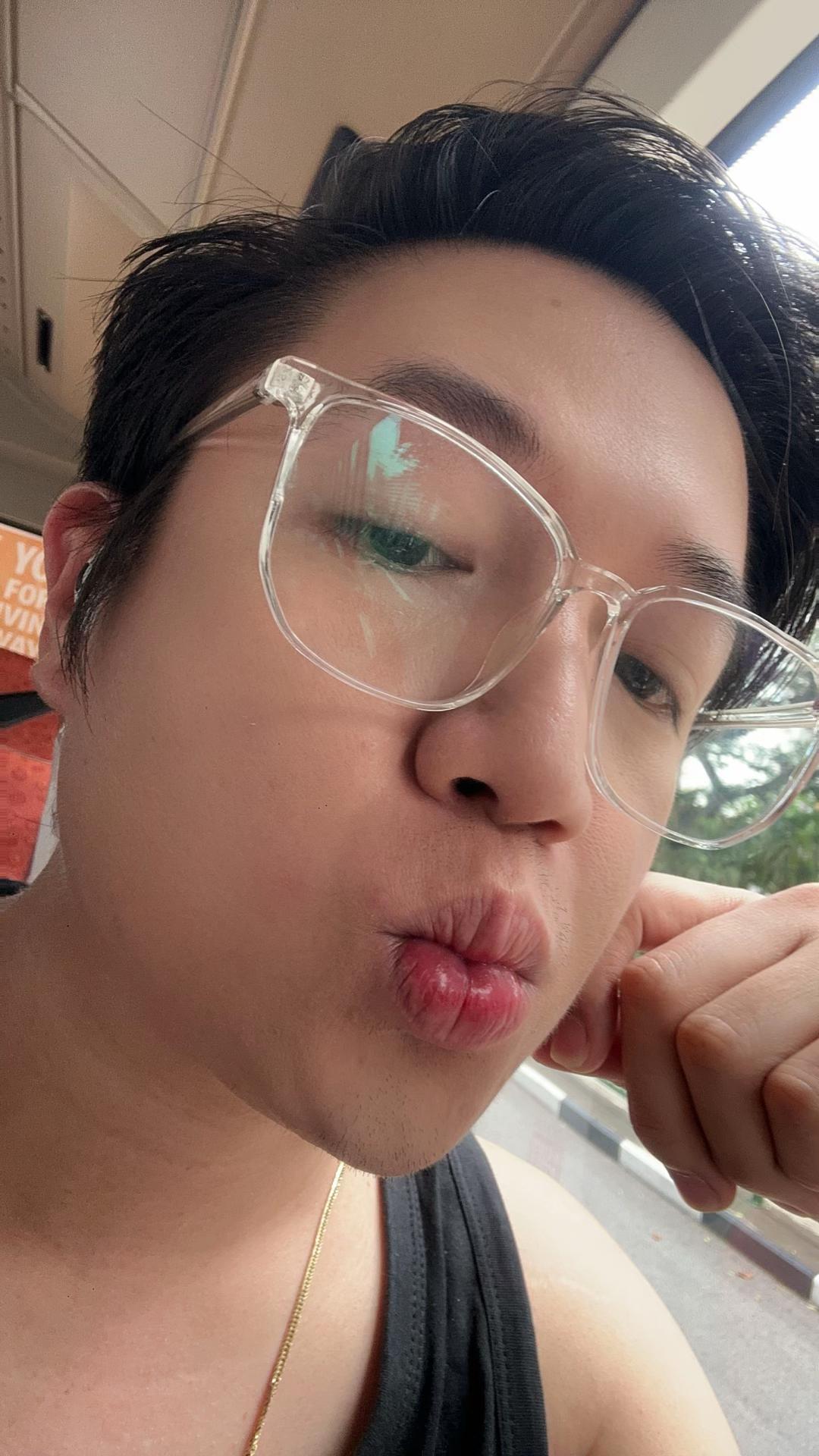 @Nurse Elot 🧑🏼&zwj;⚕️🇸🇬