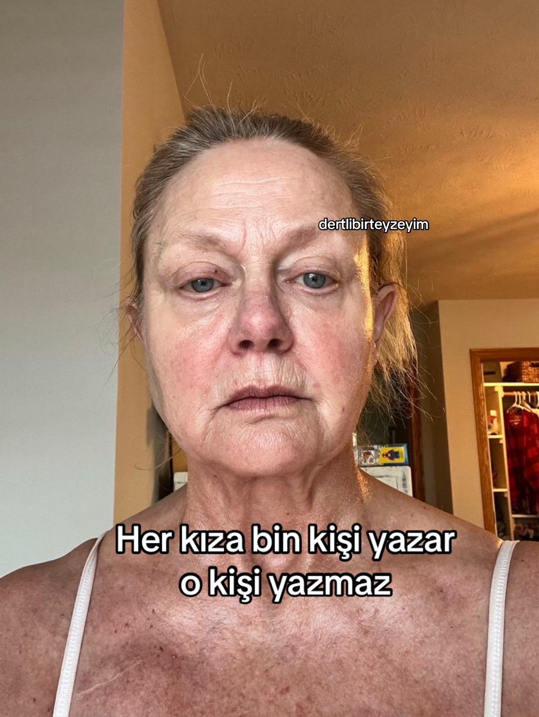 @dertlibirteyzeyim