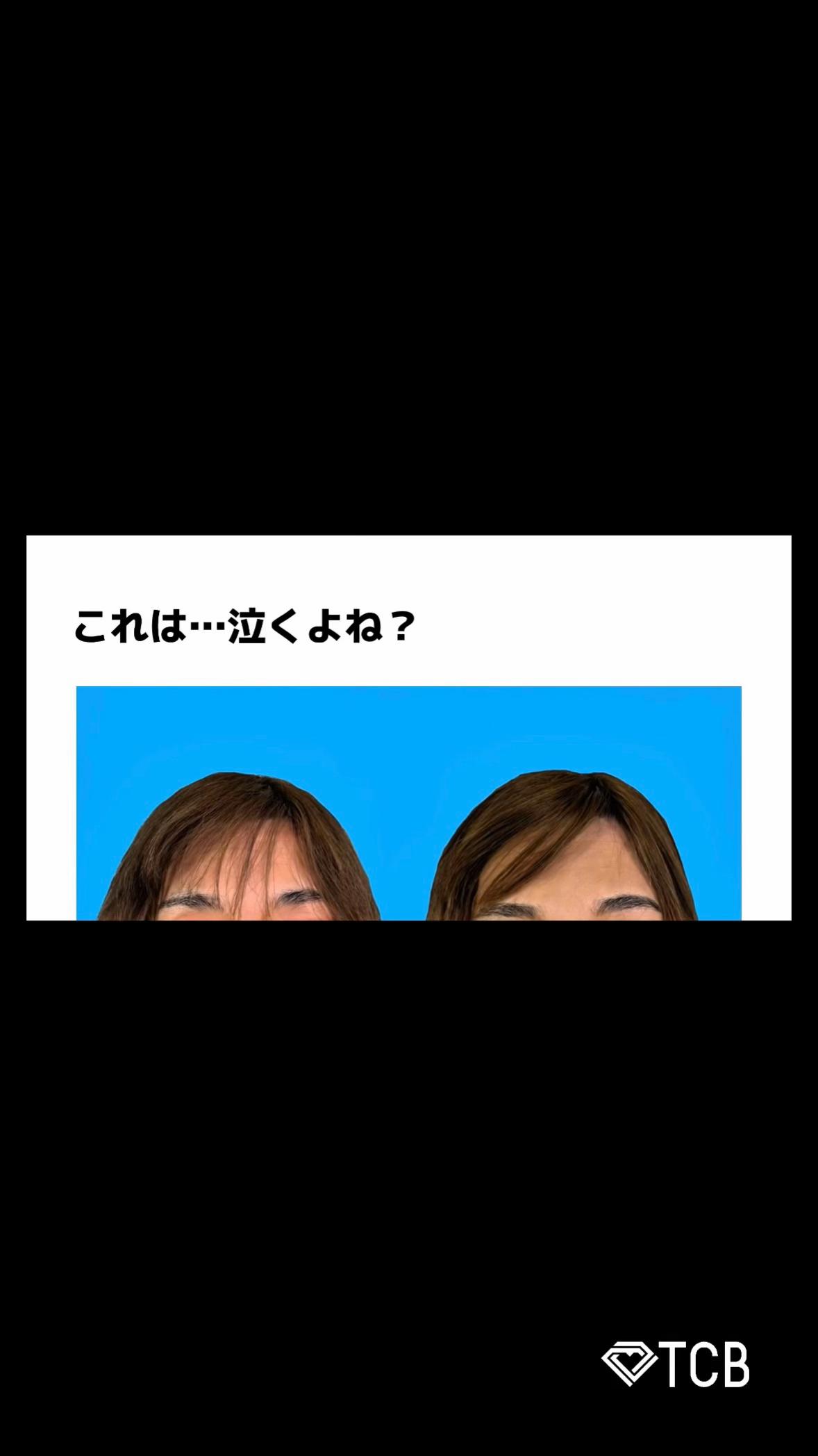 @【二重整形】TCB 新宿東口院ゆいこ先生/東京