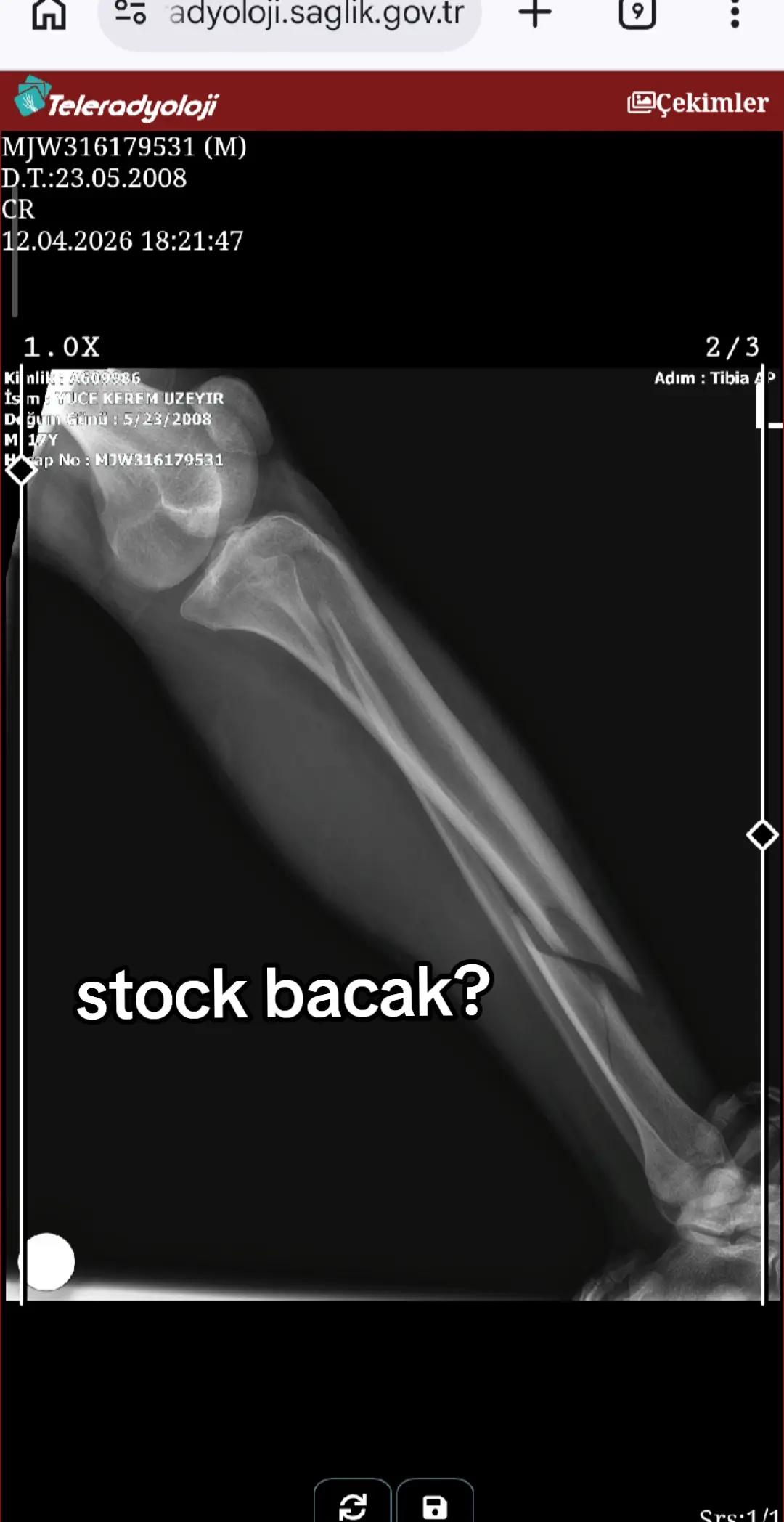 @kerolika