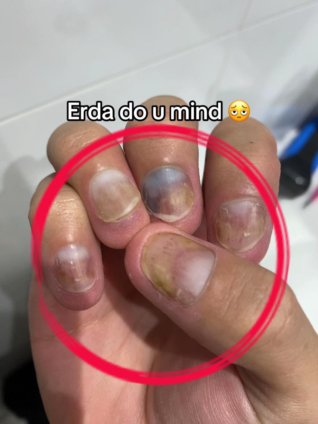 @skifee