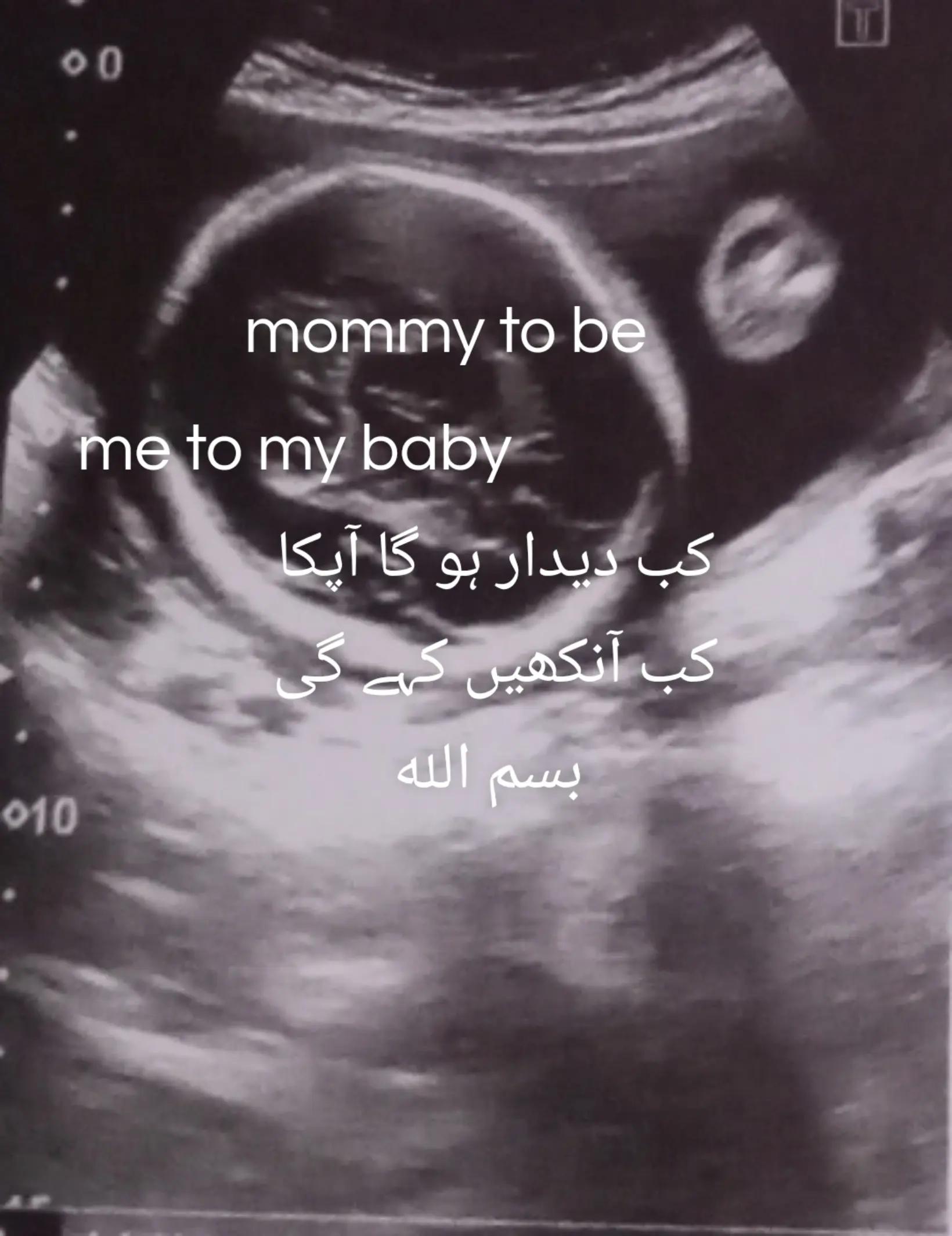 @Mommy to be