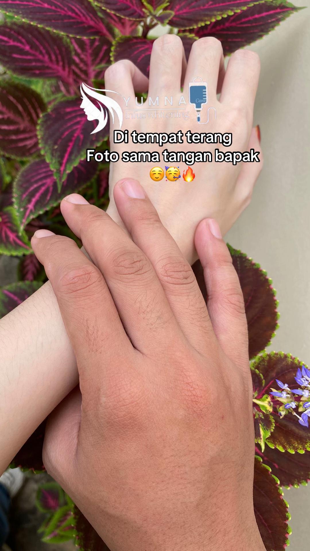 @yumna whitening 1