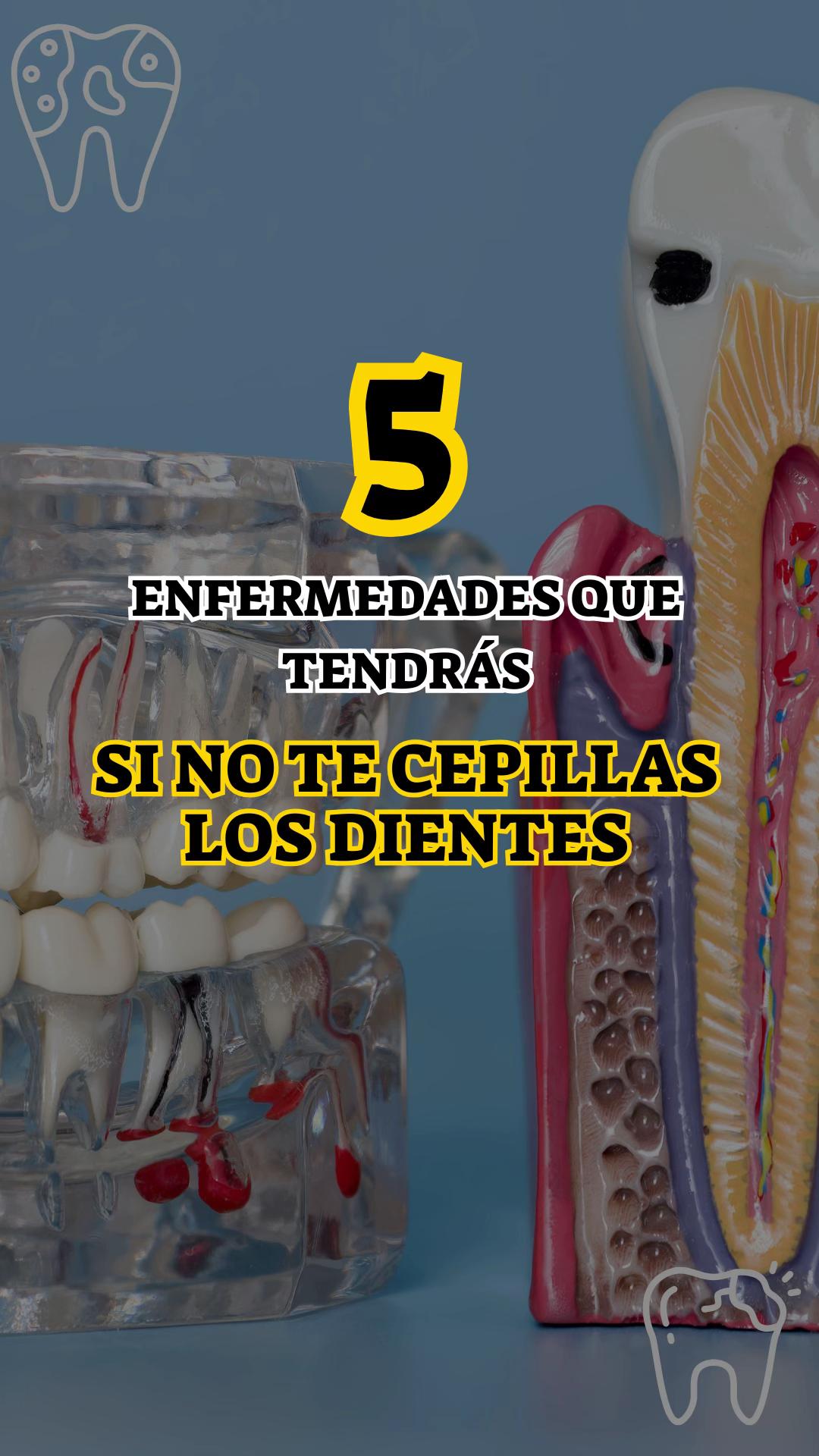 @Brackets y Alineadores