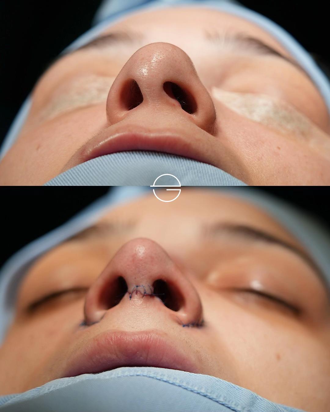 @Eliana Garcés Plastic Surgery