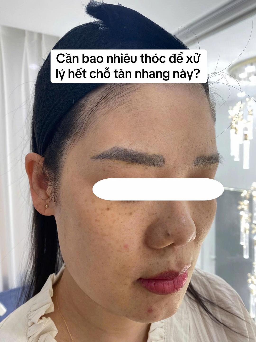 @HD SKIN